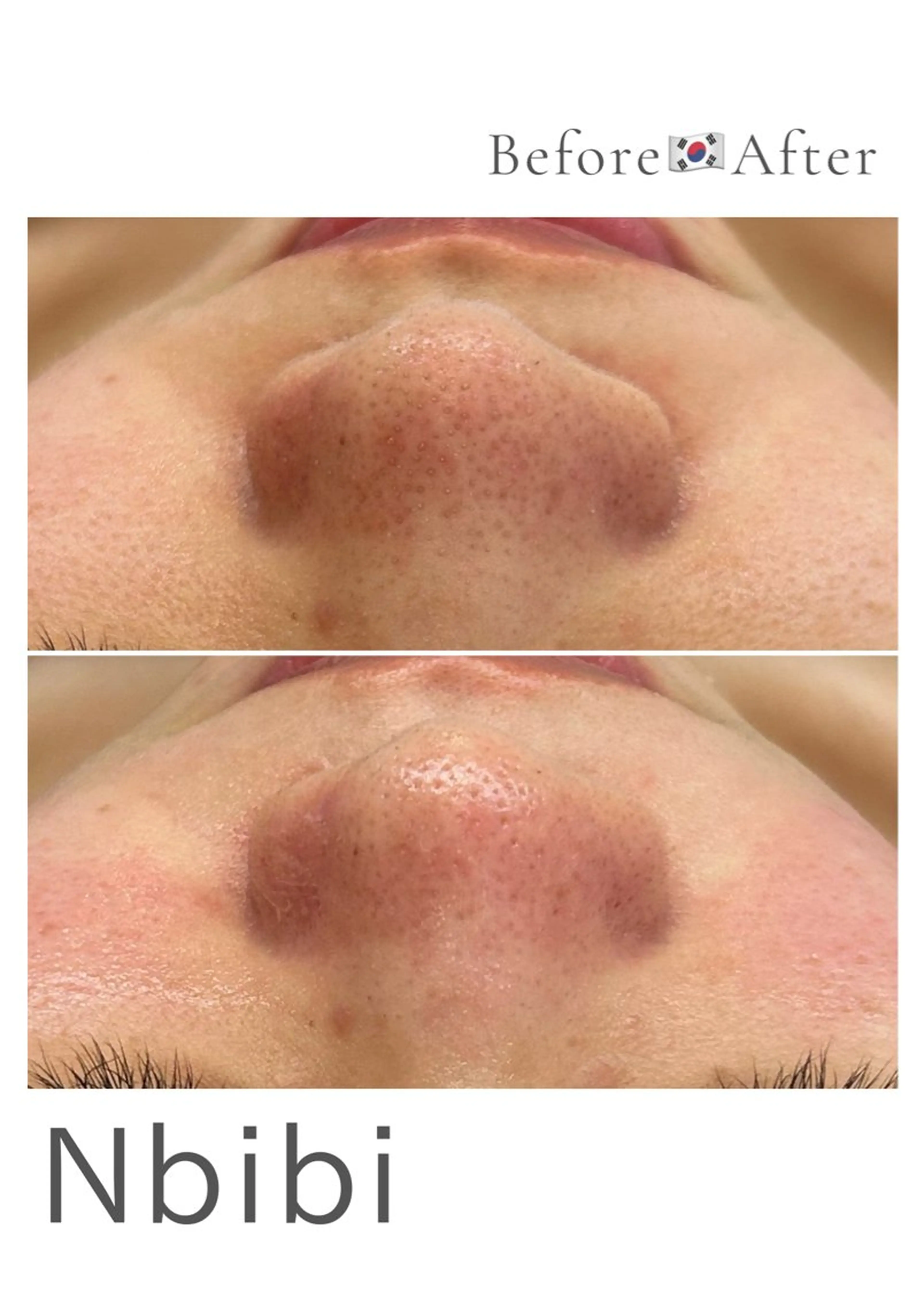 エステ 韓国🇰🇷価格 サロン_Nbibiの眉毛・アイブロウイメージ