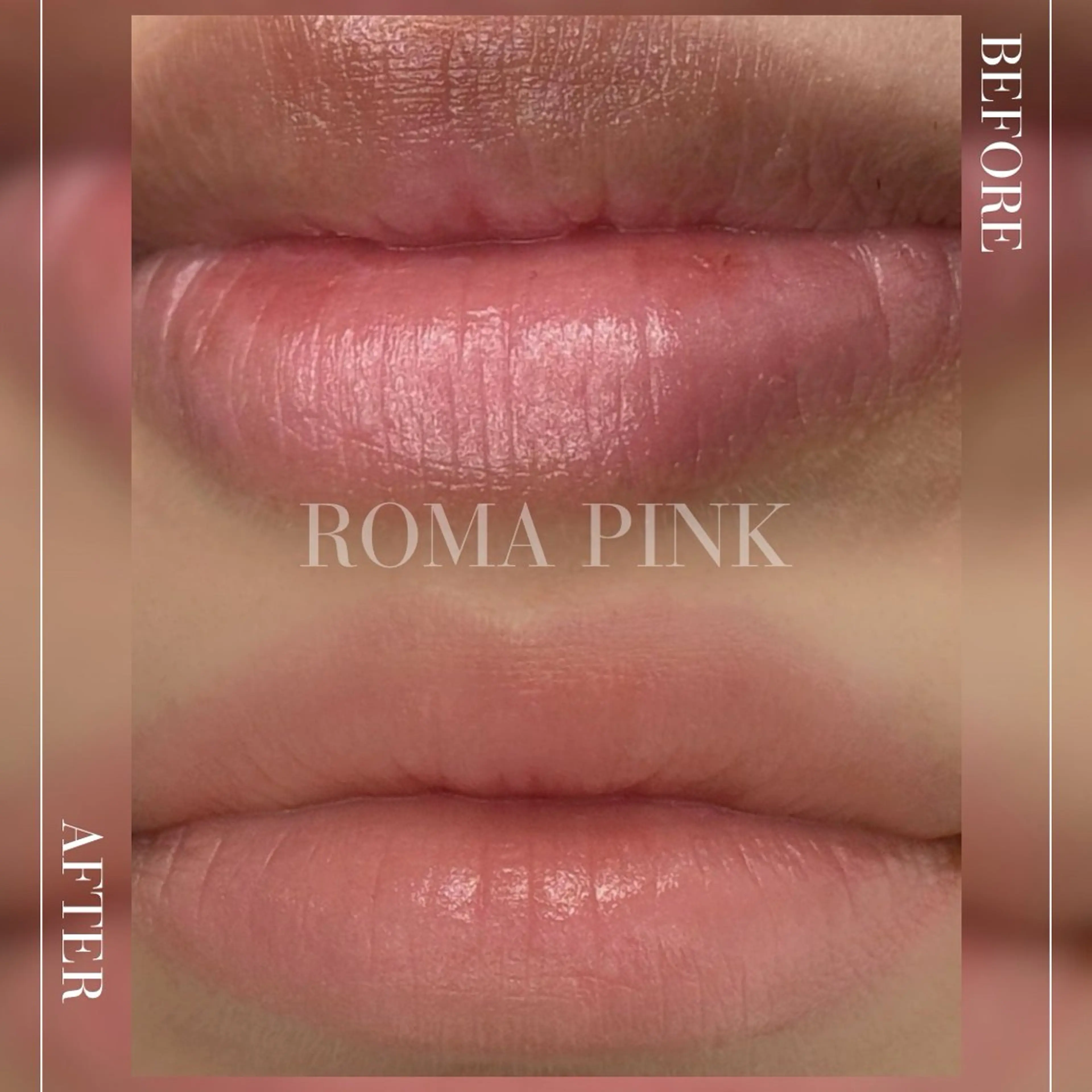 小顔と美肌サロン クリニカルサロンココのエステ・リラクイメージ