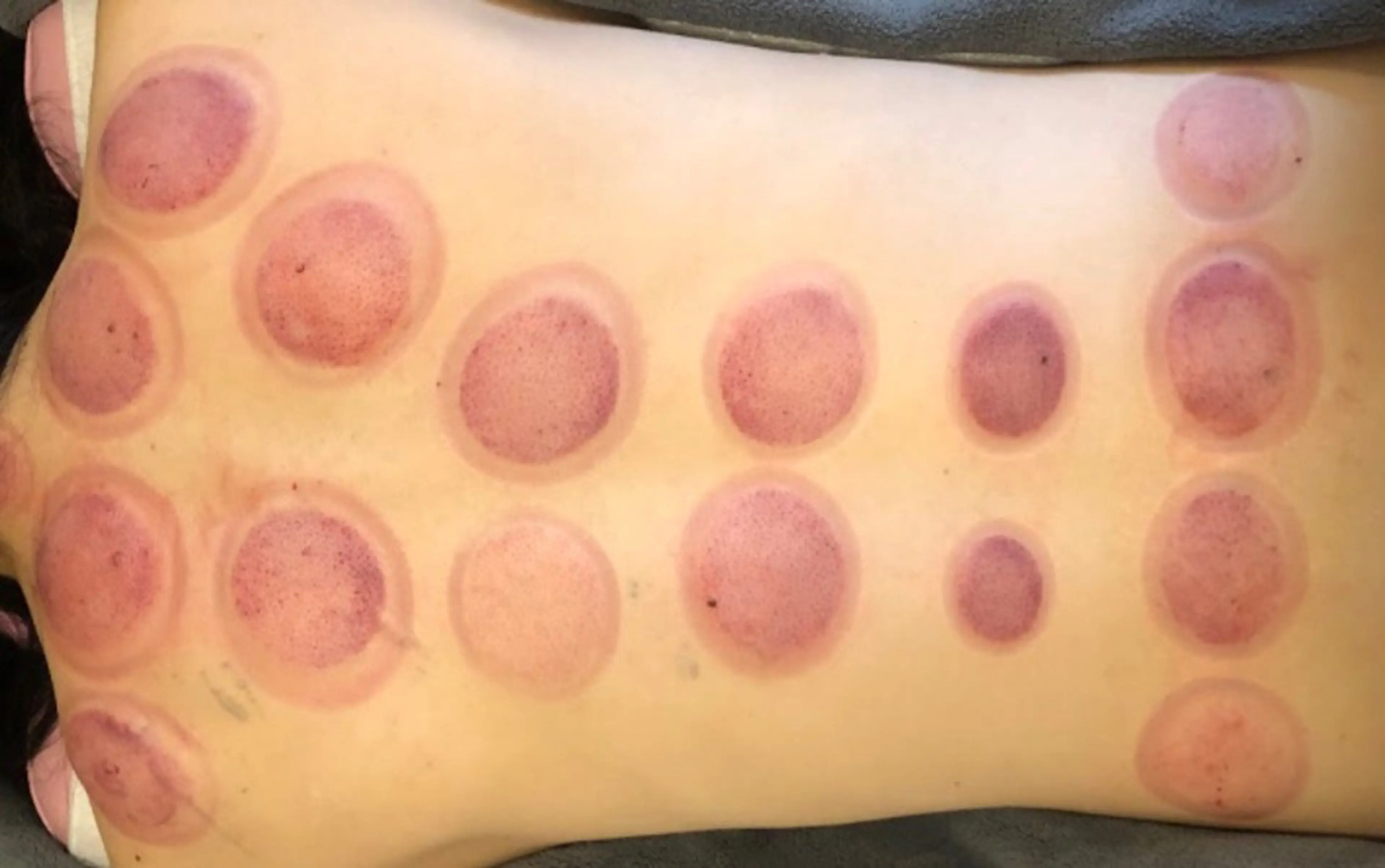 かすがい鍼灸院 Re.heartのエステ・リラクイメージ