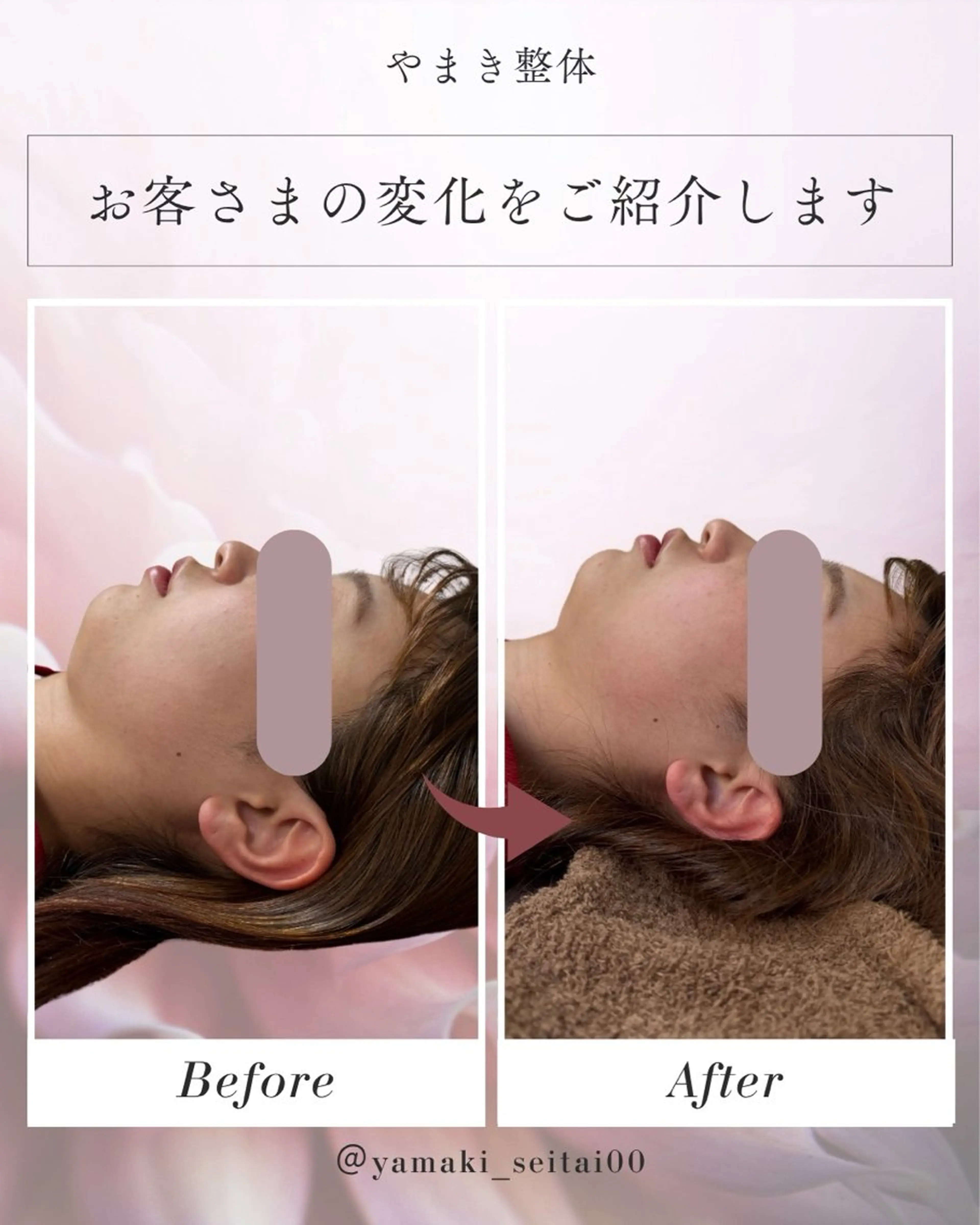 【本来の美しさへ】小顔整体体験！！の写真