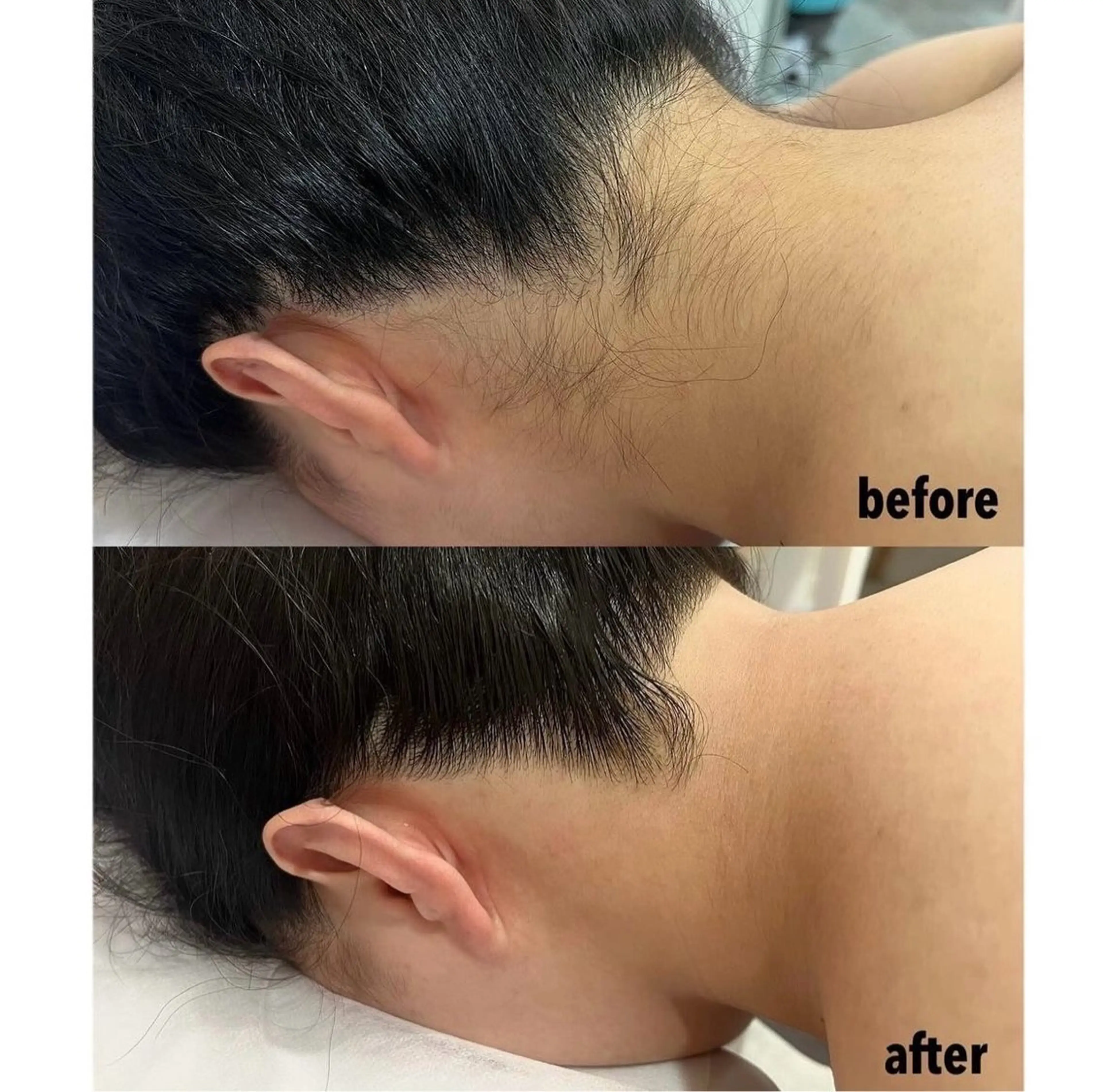 脱毛 瀬戸 梨子のエステ・リラクイメージ