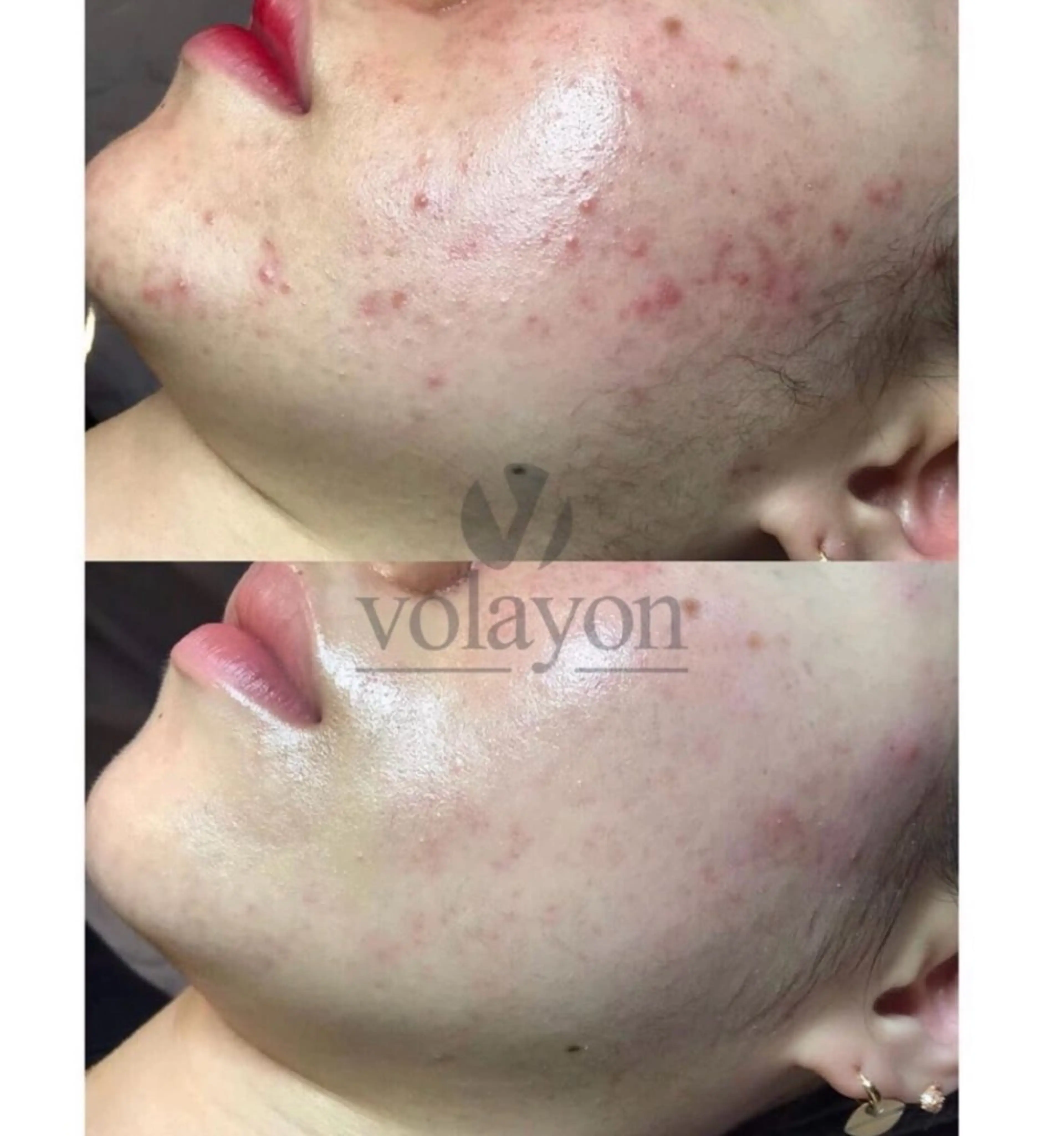 エステ リラク 【韓国肌管理・脱毛】 クレセントのその他イメージ