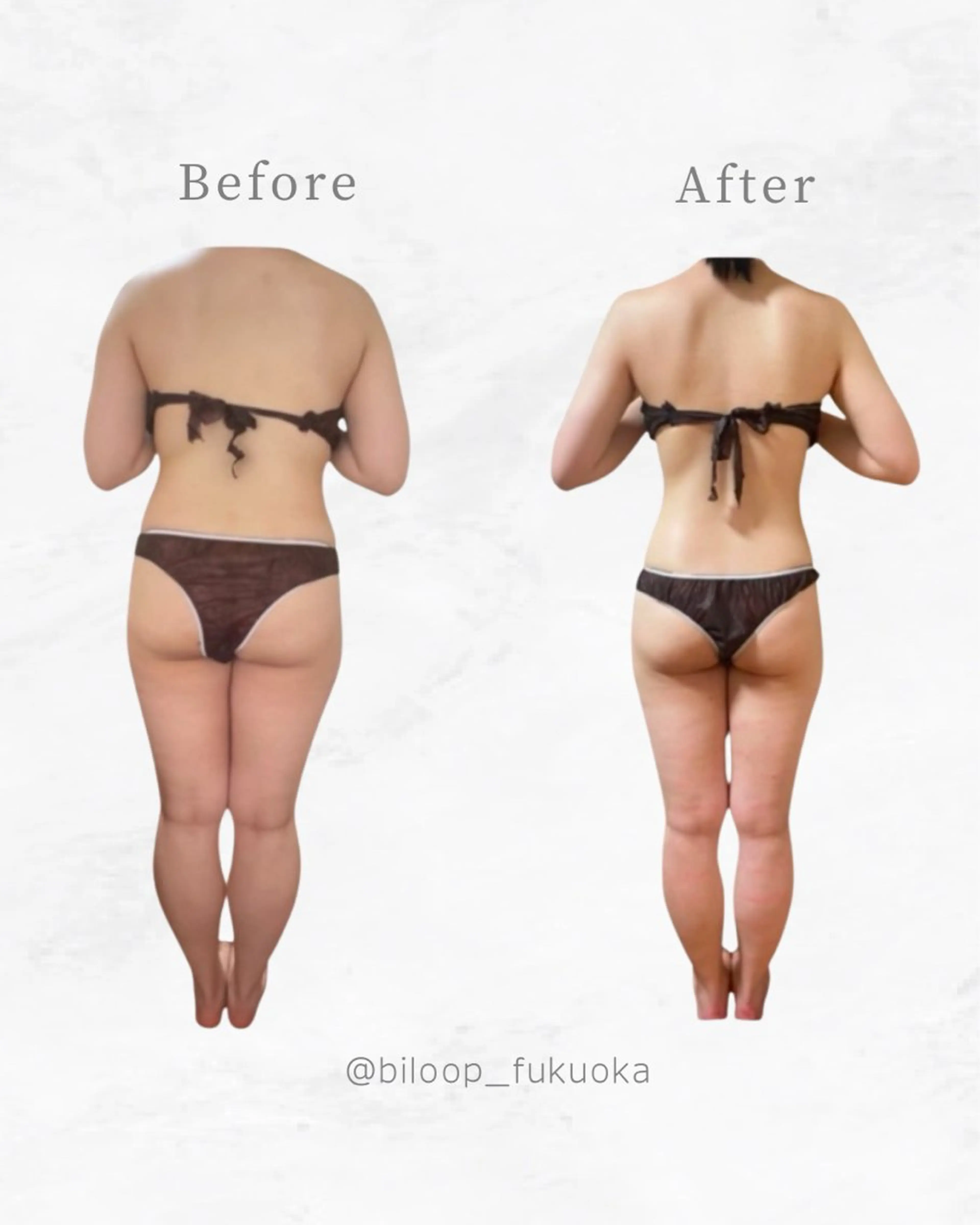 エステ リラク 《本気痩せ×疲労改善 》  BILOOPのエステ・リラクイメージ