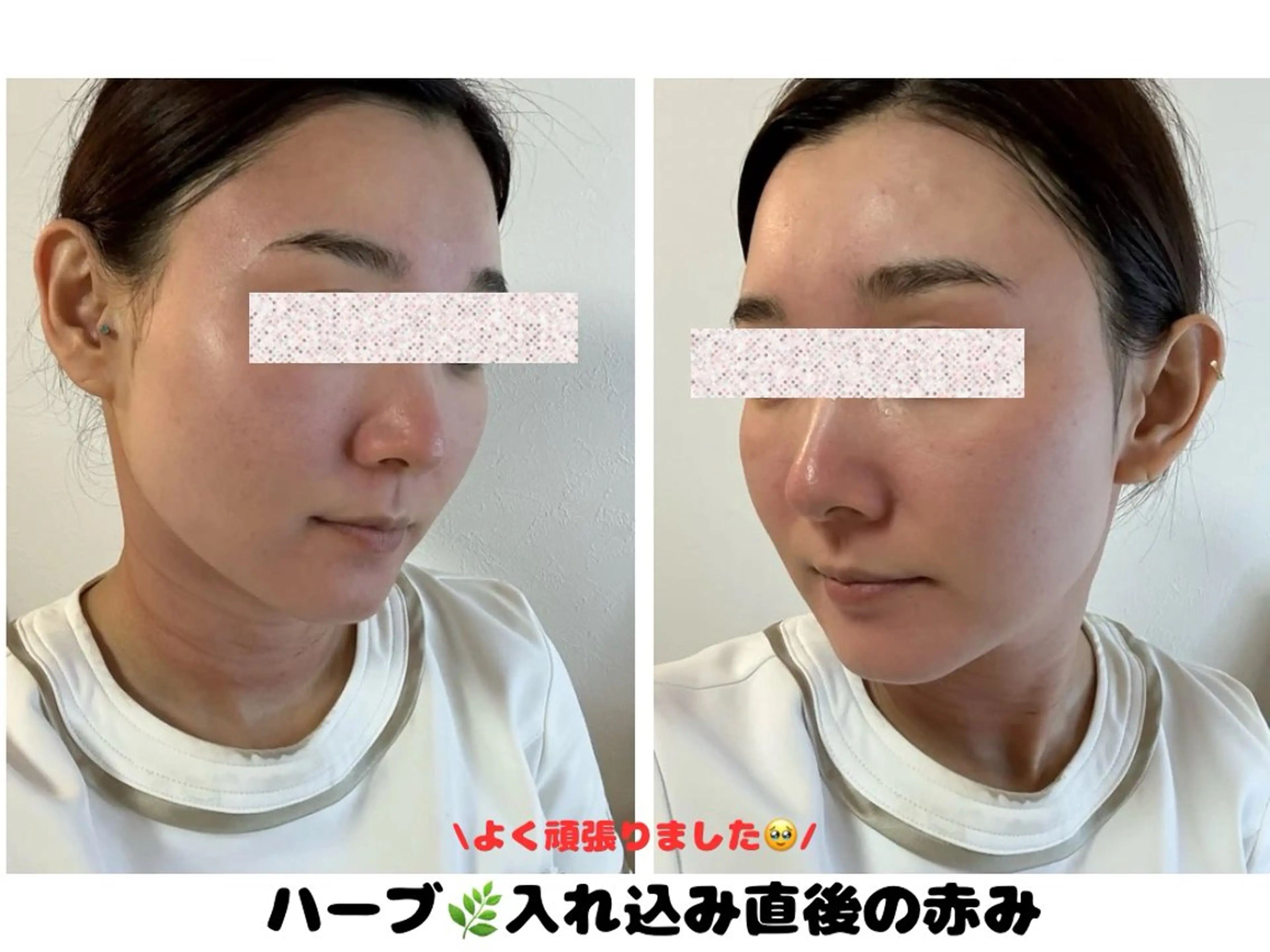 VIKI BEAUTY  クレイハーブピーリング・美肌脱毛専門店所属・VIKI BEAUTYのエステ・リラクイメージ