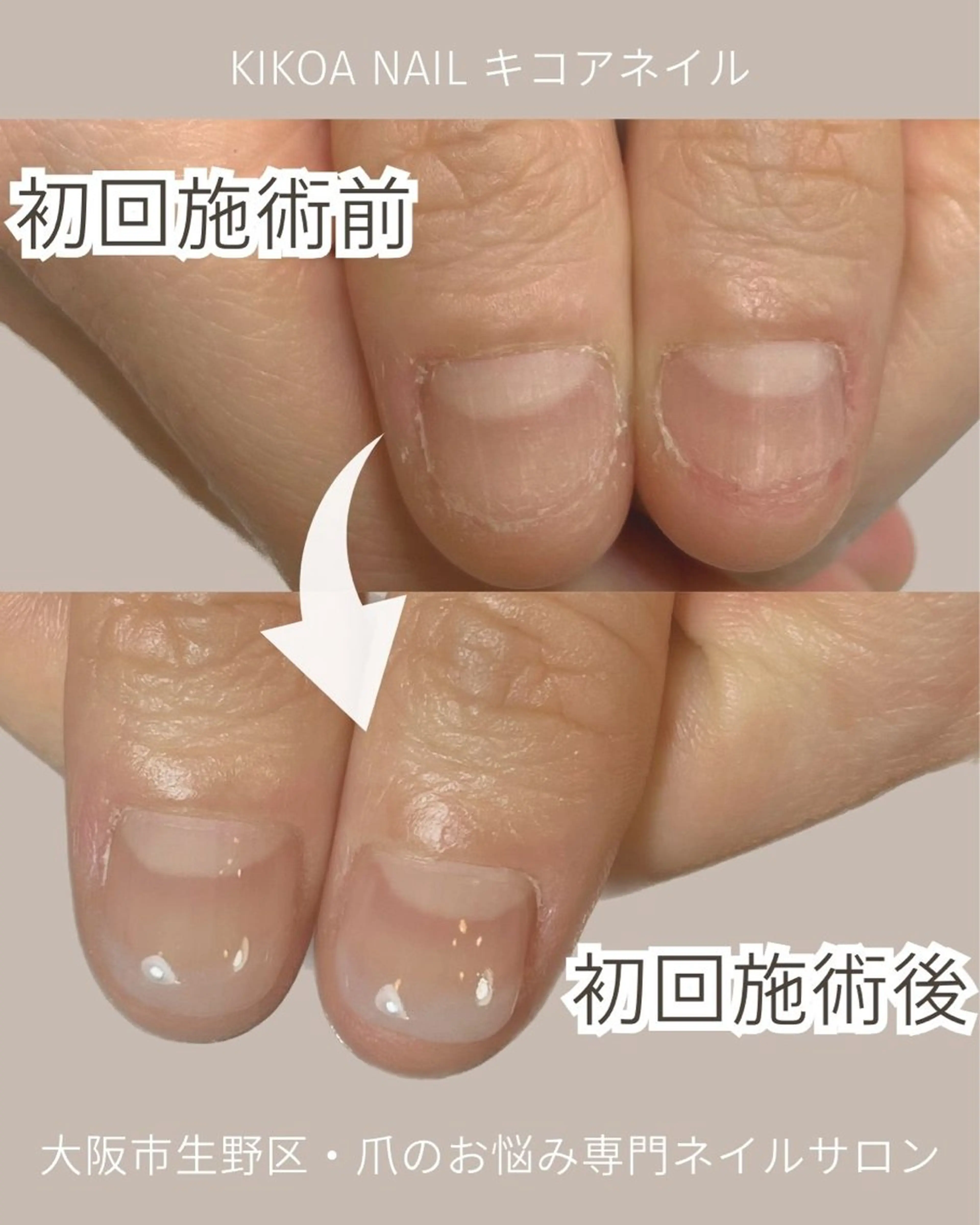ネイル KIKOA NAIL キコアネイルのネイルデザイン
