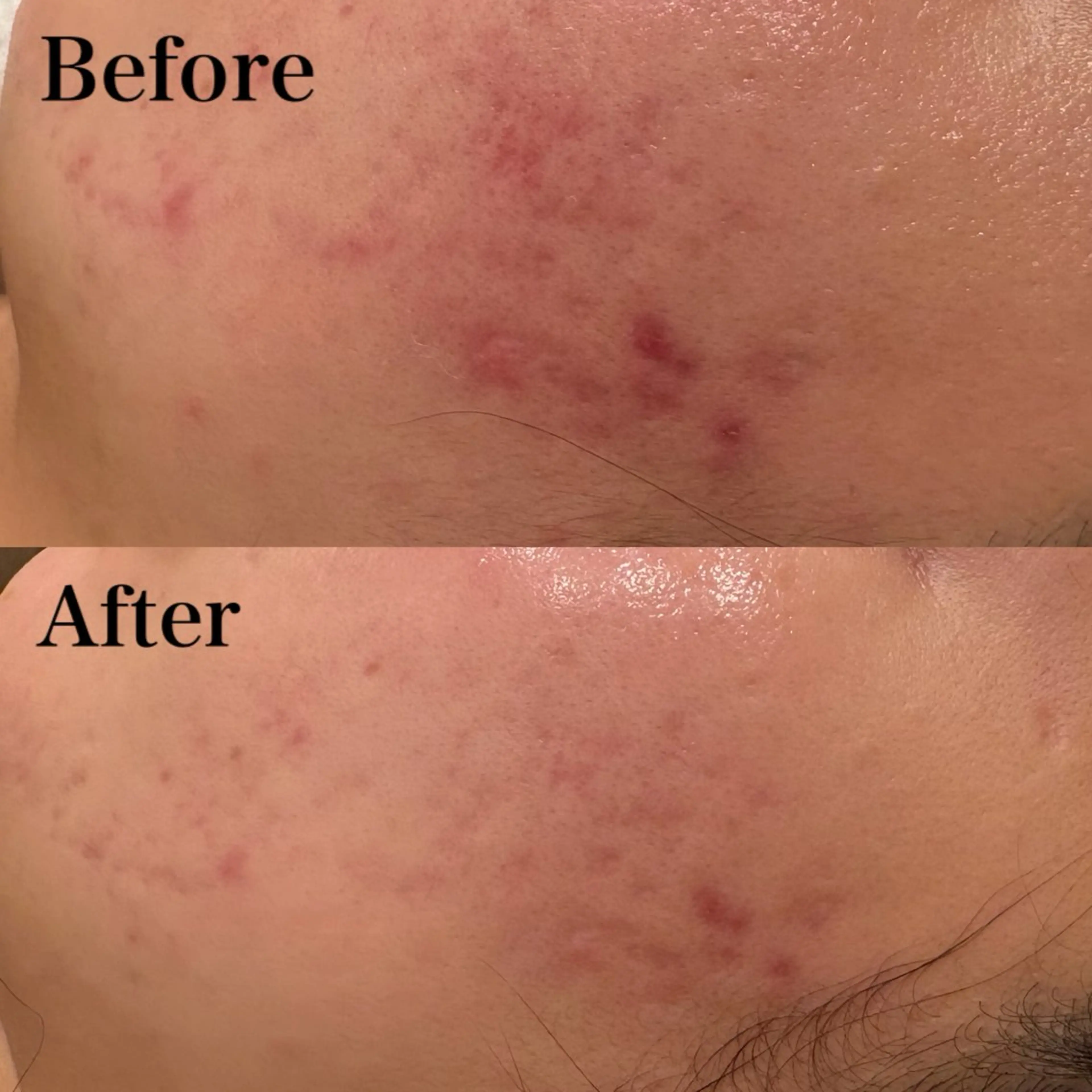 seika🍒 ハリラウンジ梅田のエステ・リラクイメージ