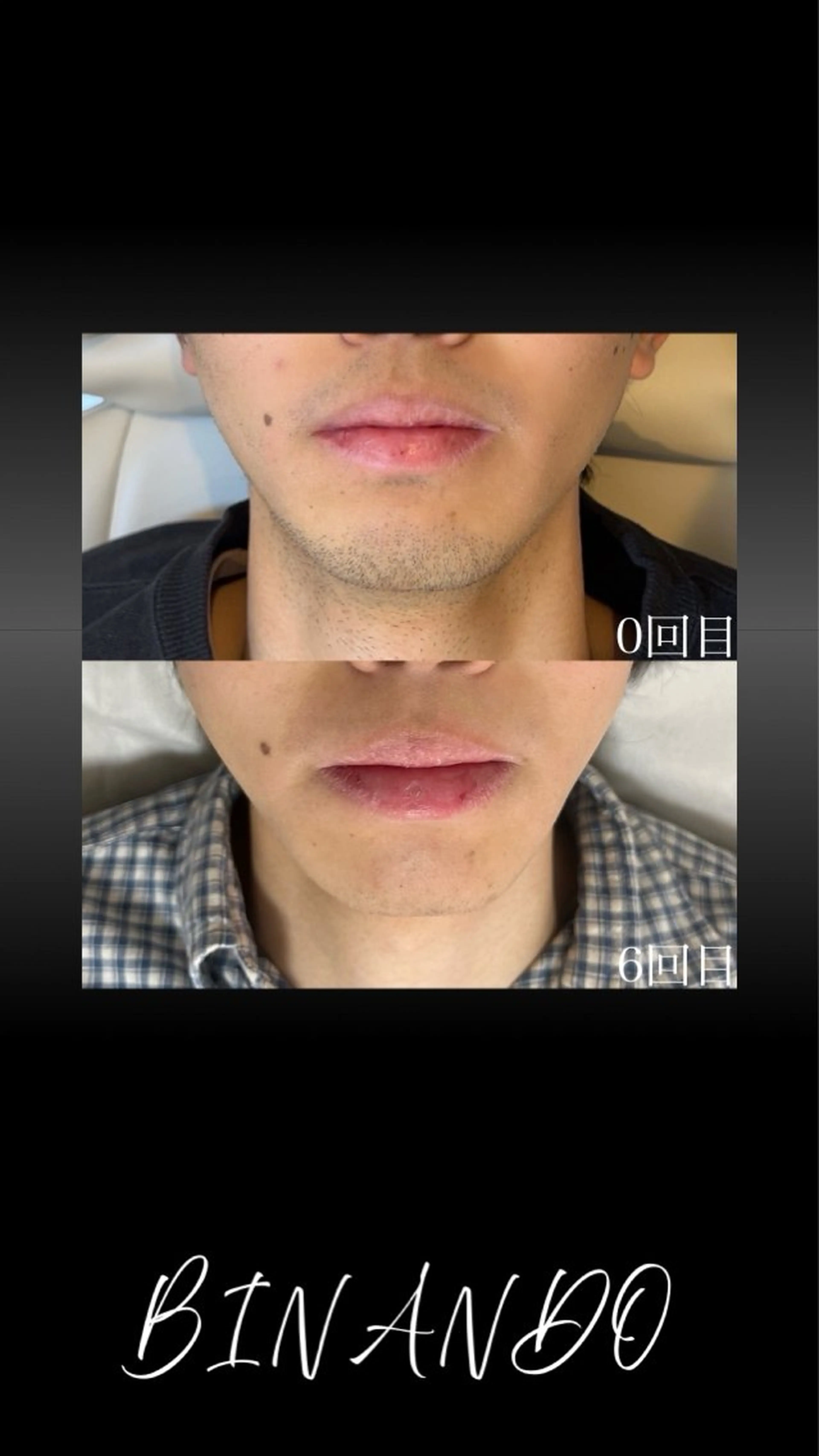 メンズ 脱毛 BINANDO 桑原の眉毛・アイブロウイメージ