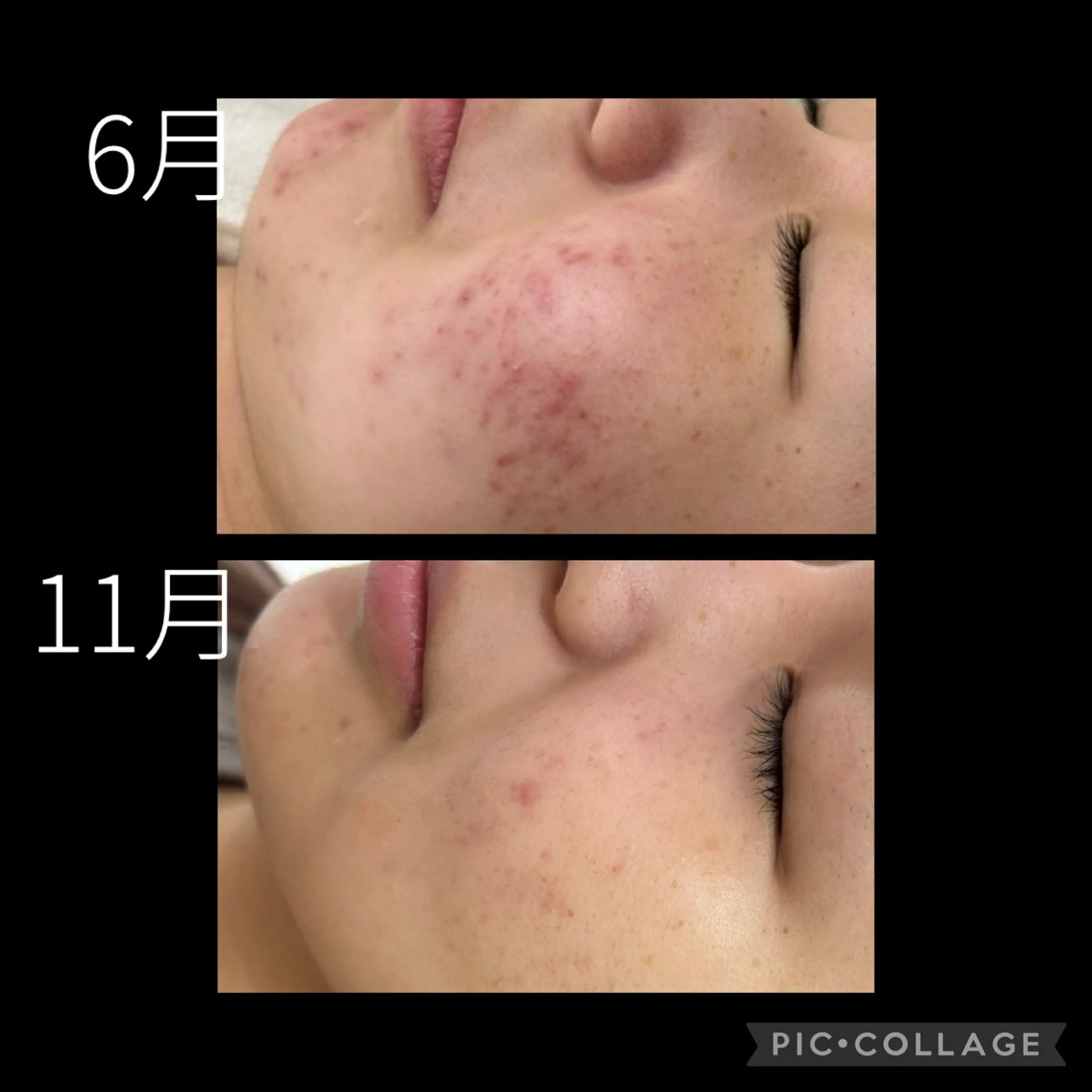 DeI'm柴田所属・自爪育成× 肌質改善サロンのエステ・リラクイメージ