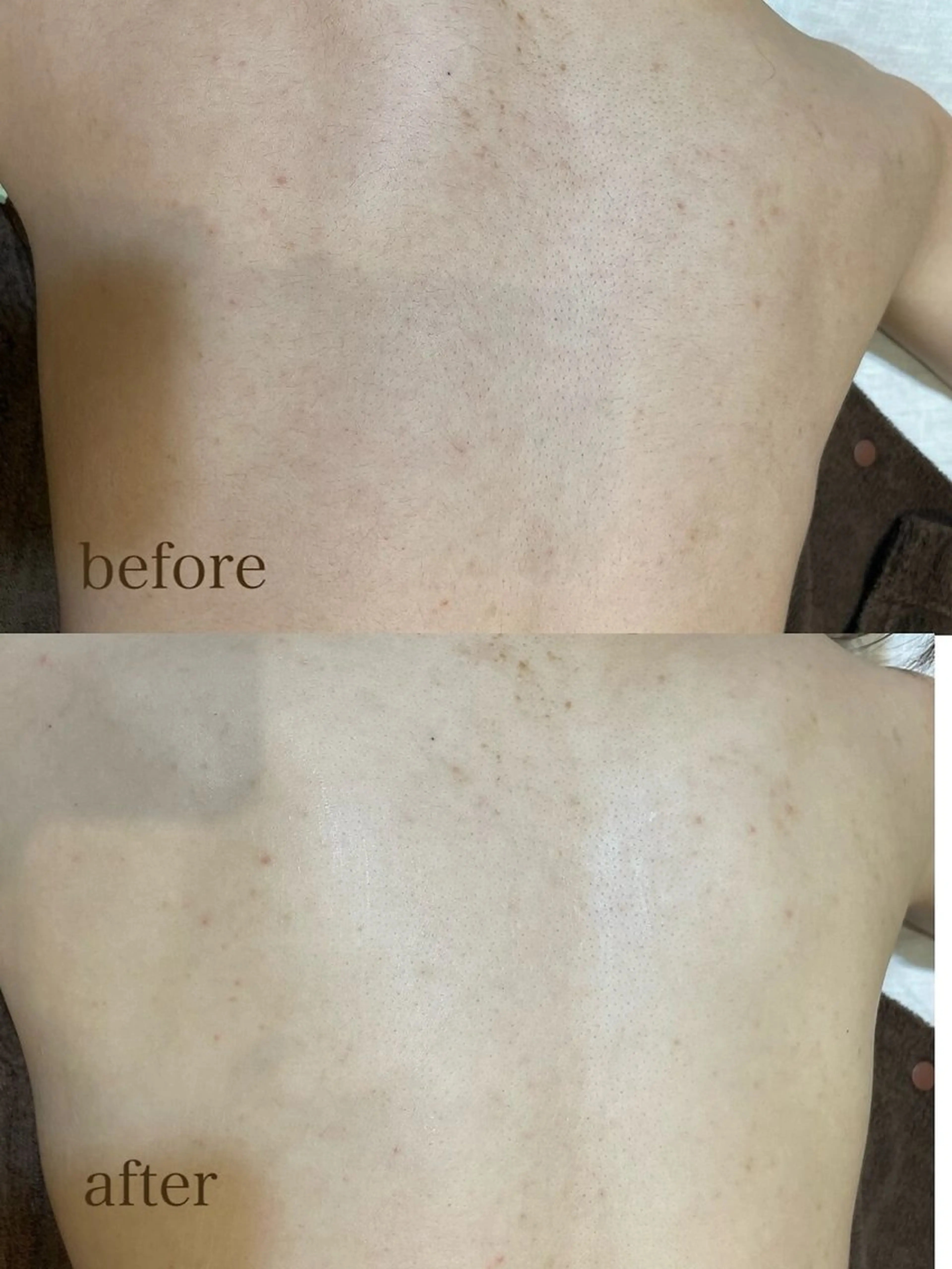 ✨襟足、お背中​〜​腰までシェービング✨の写真