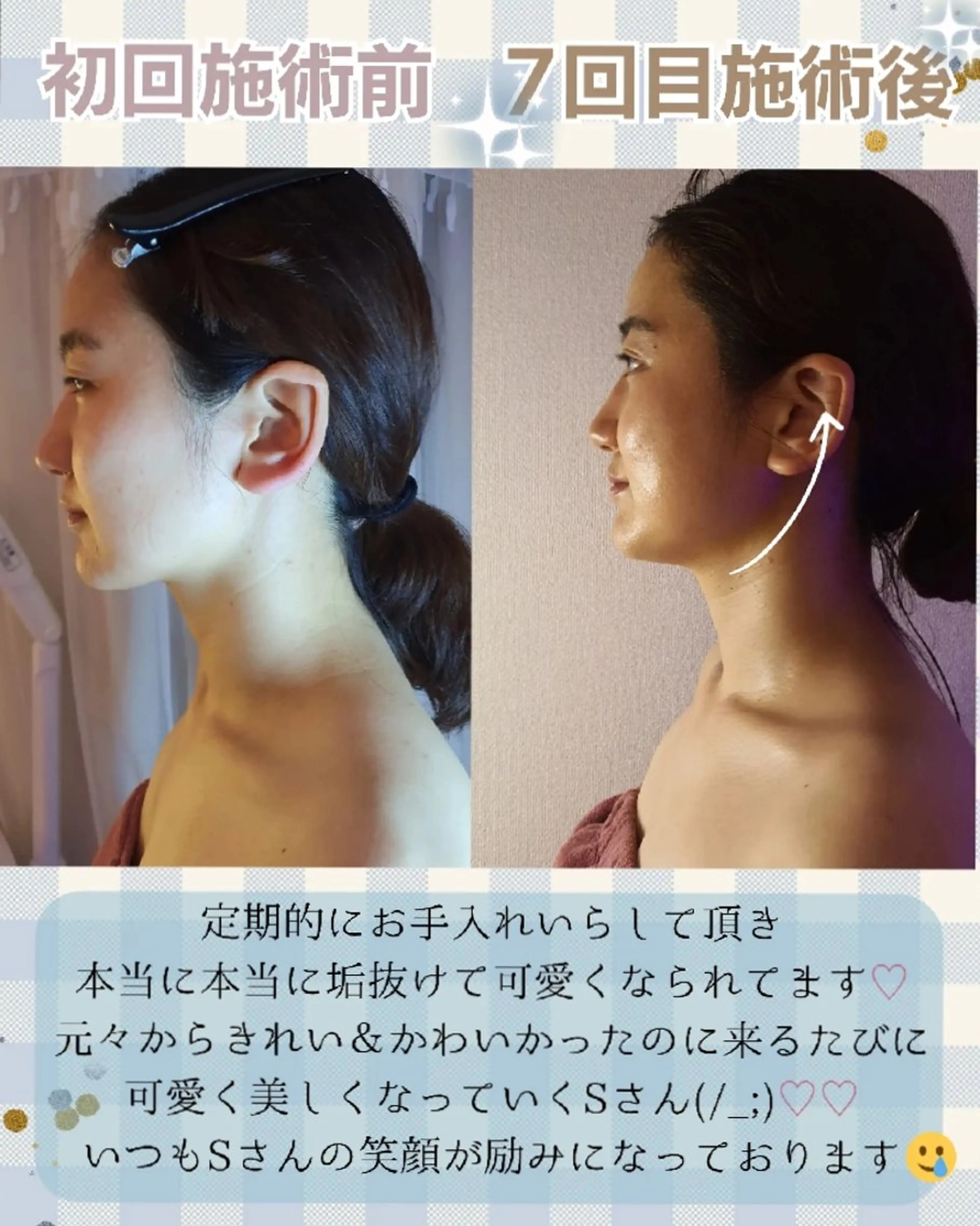 エステ リラク 痩身ハーブピーリング 筋膜リリース☆B&Hのエステ・リラクイメージ