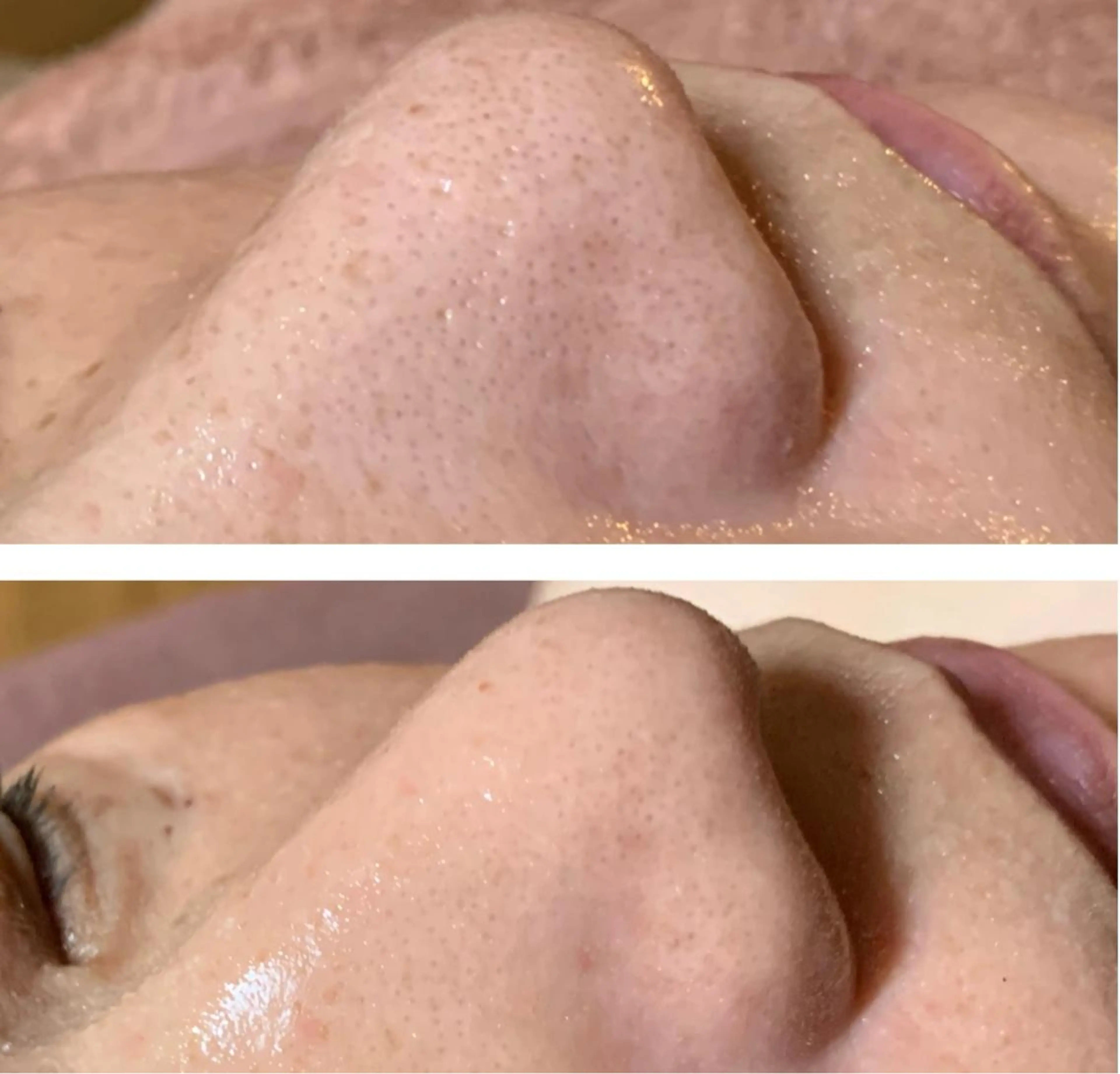 バストアップ専門/デ トックス/小顔コルギのエステ・リラクイメージ