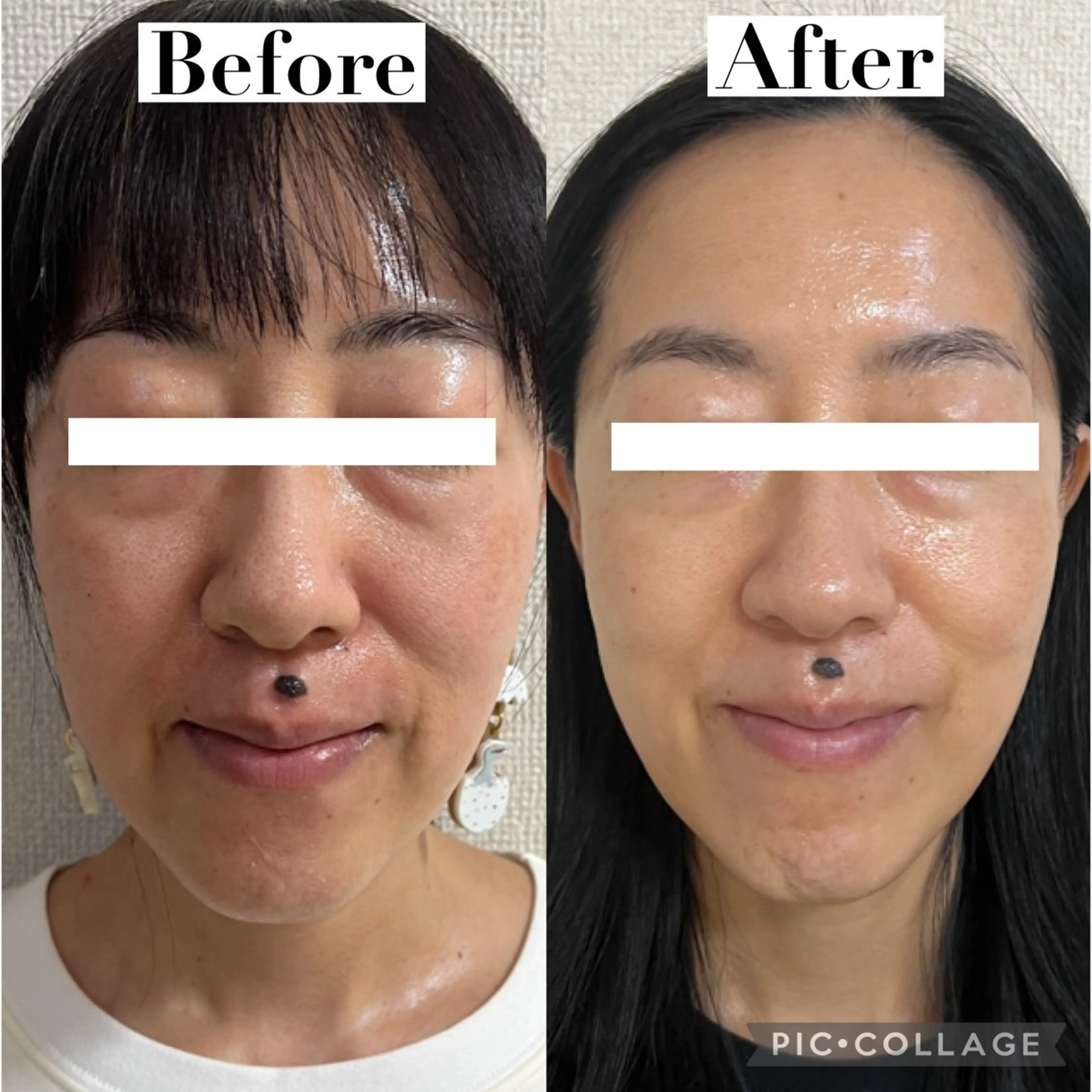 エステ リラク たるみ改善サロン Ｍdesignのエステ・リラクイメージ