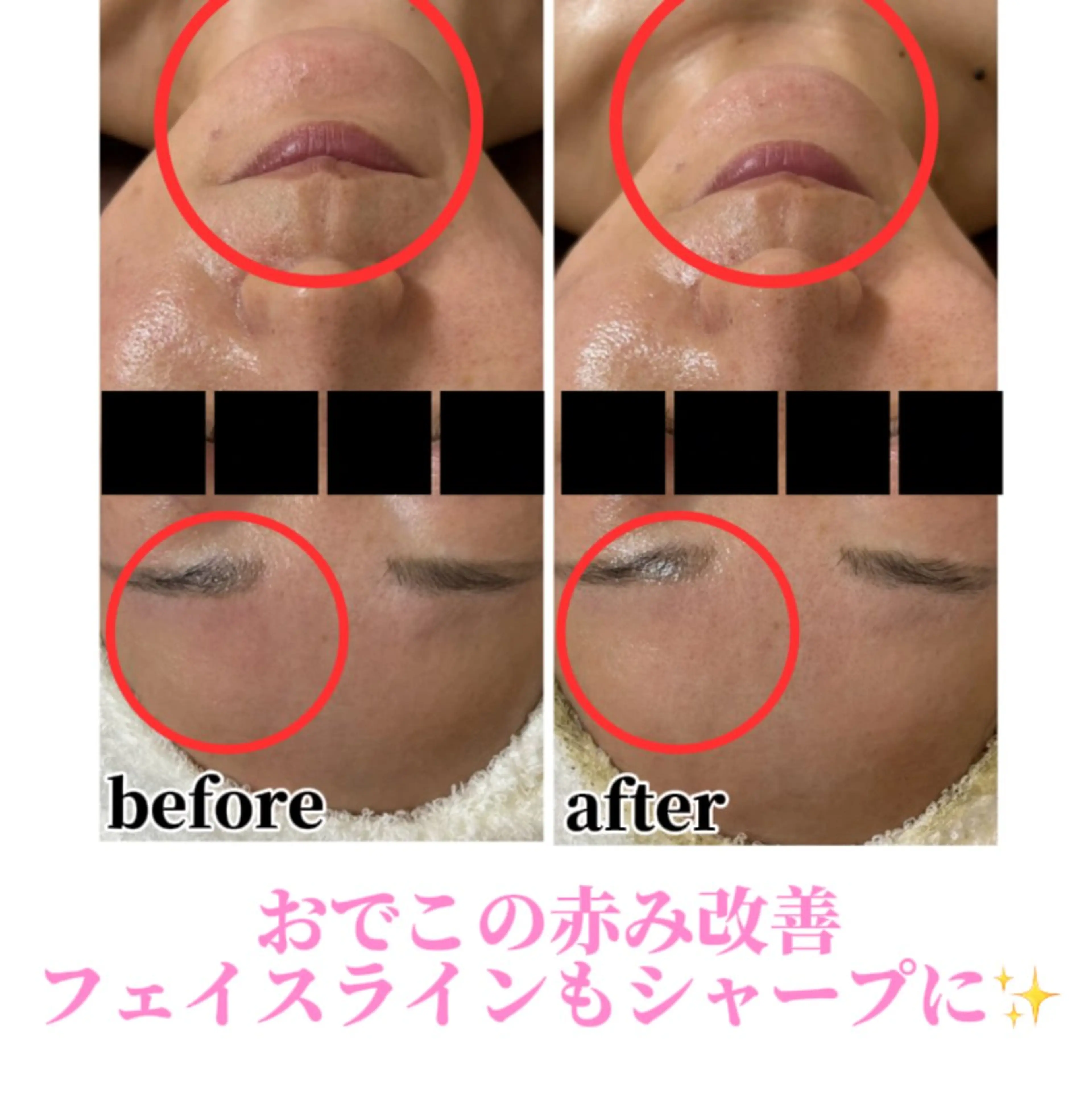 エステ Beauty salonBellのエステ・リラクイメージ