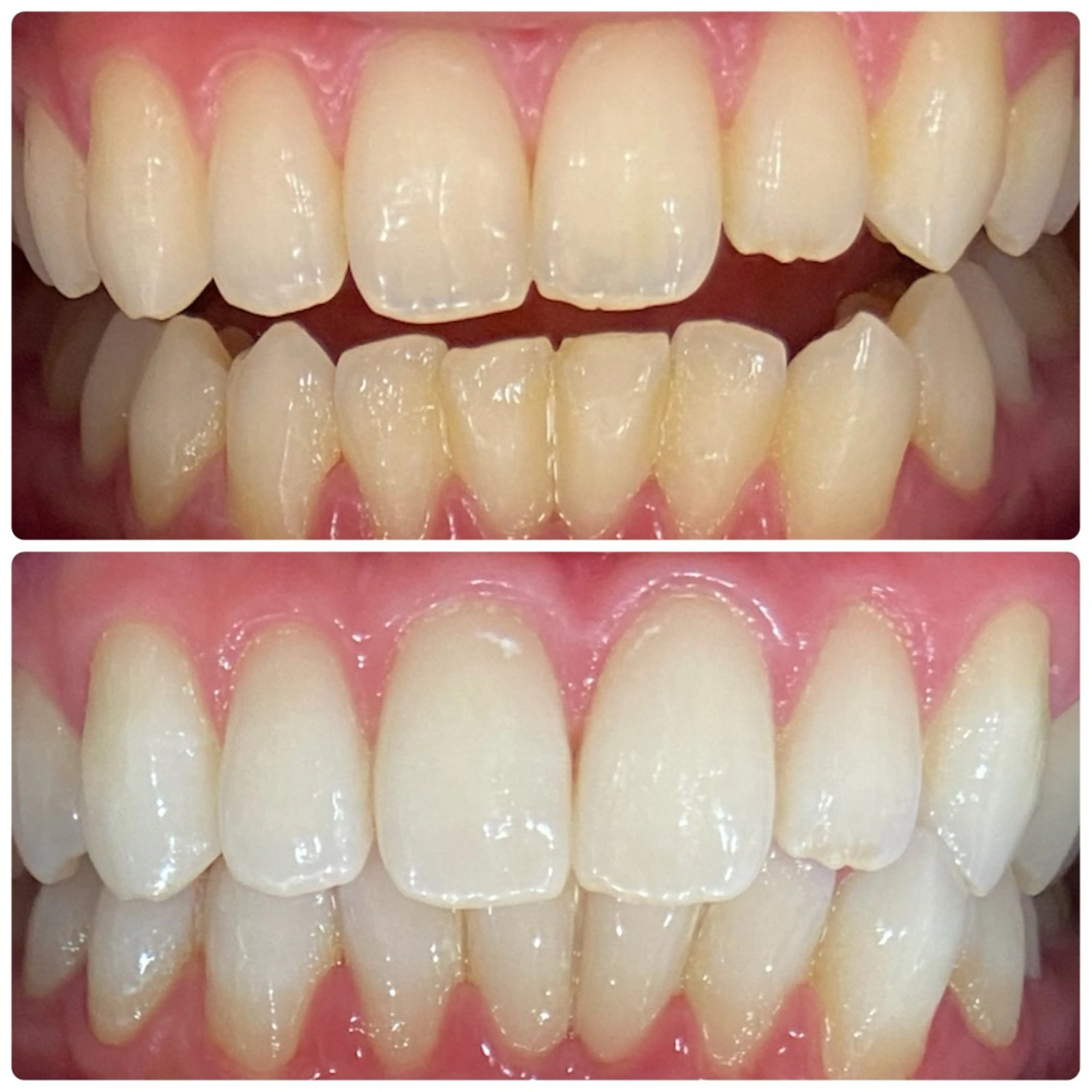 その他 ホワイトニングルーム 横浜店のその他イメージ