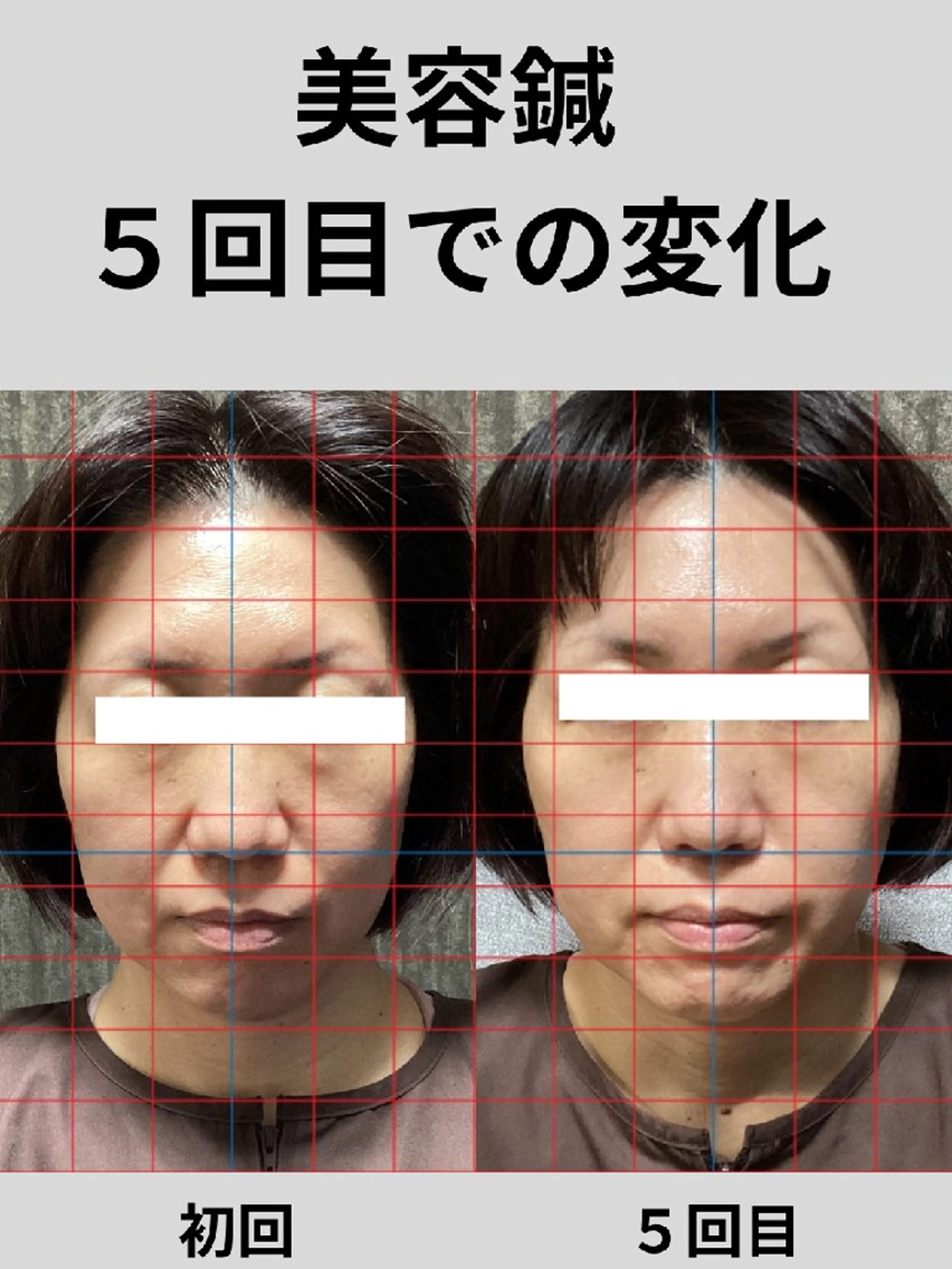 鍼灸整体院 アレンジのその他イメージ