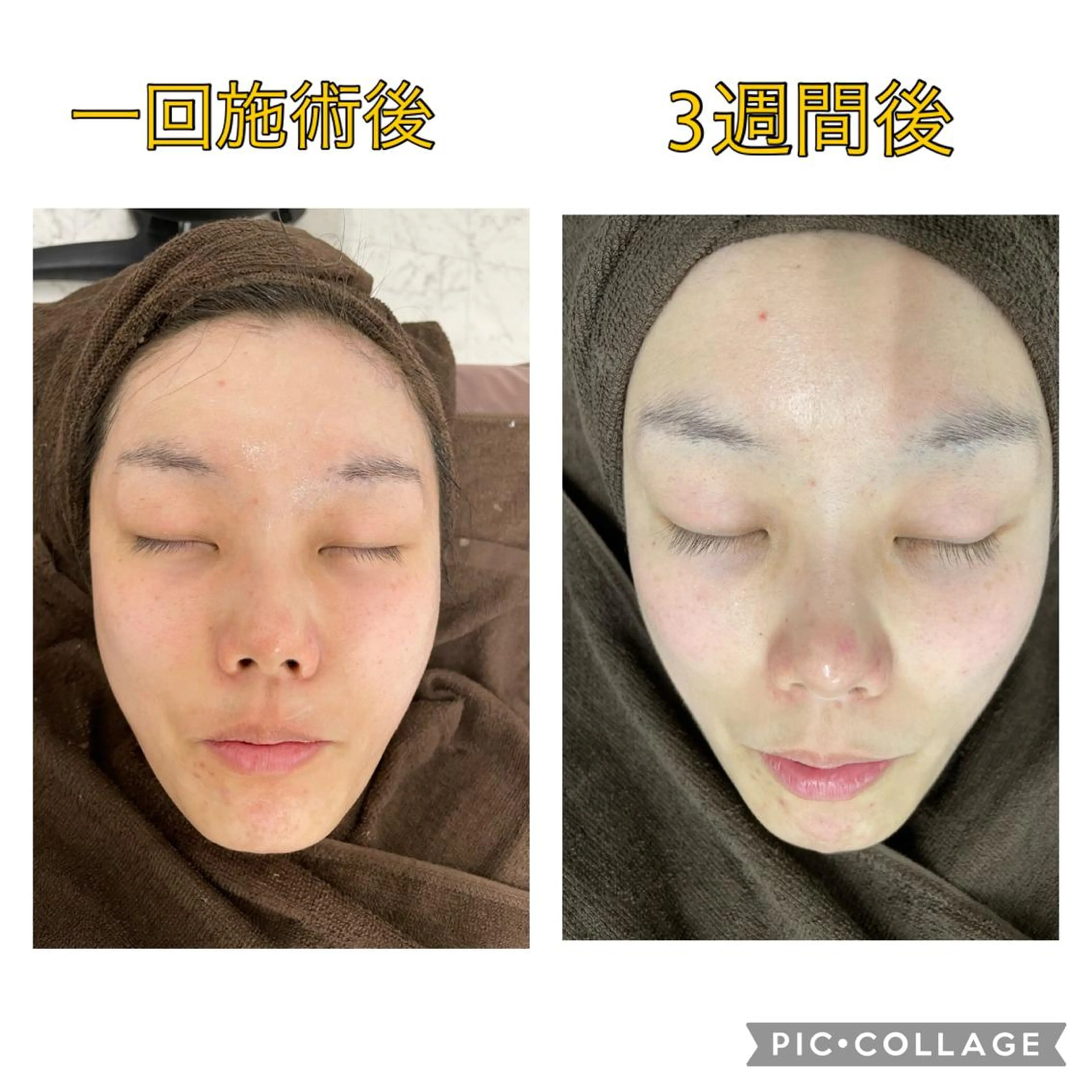 撮影モデル 古川 弥生のエステ・リラクイメージ