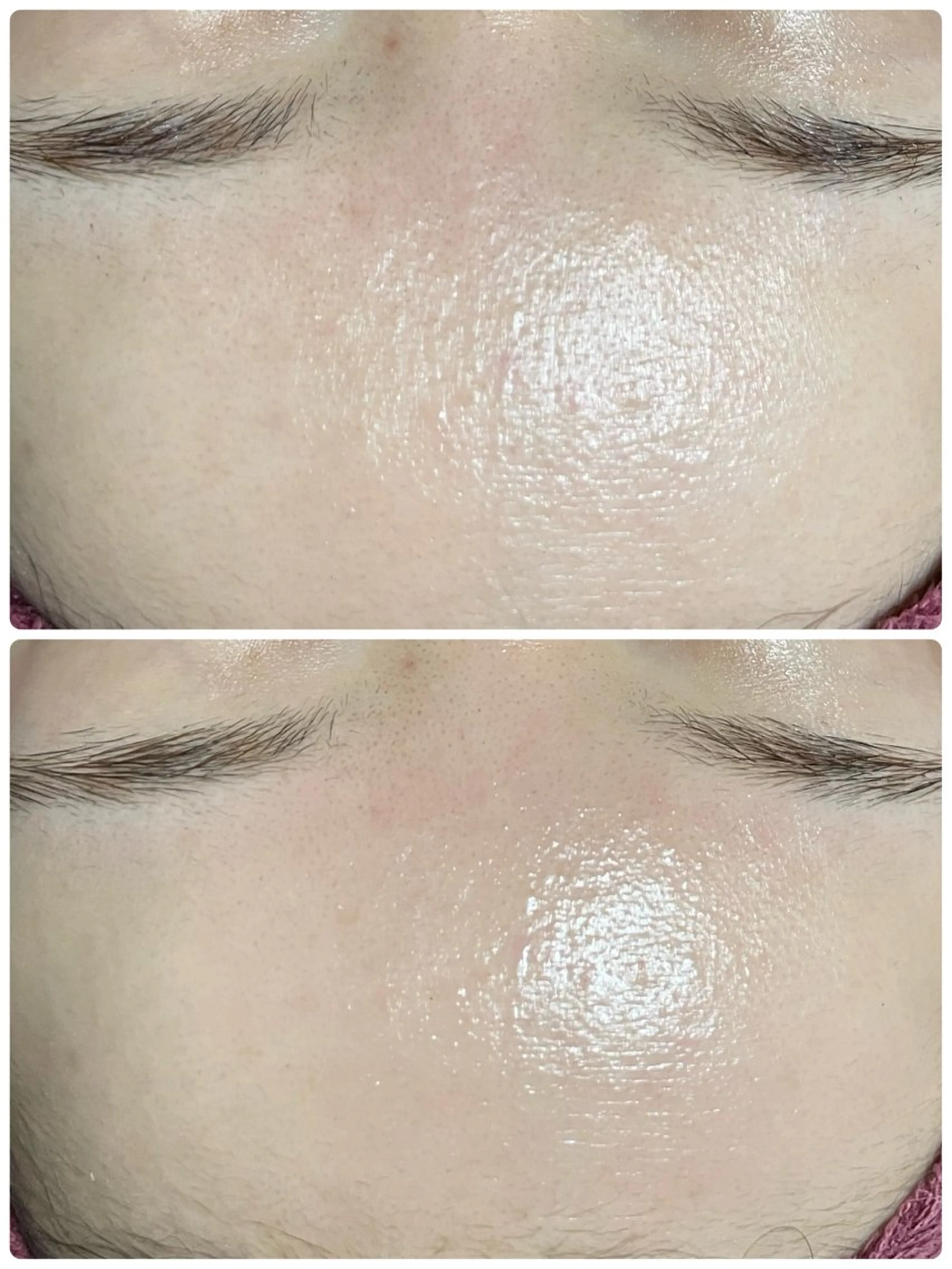 エステ REVI取扱・肌悩み 毛穴Chalonのエステ・リラクイメージ