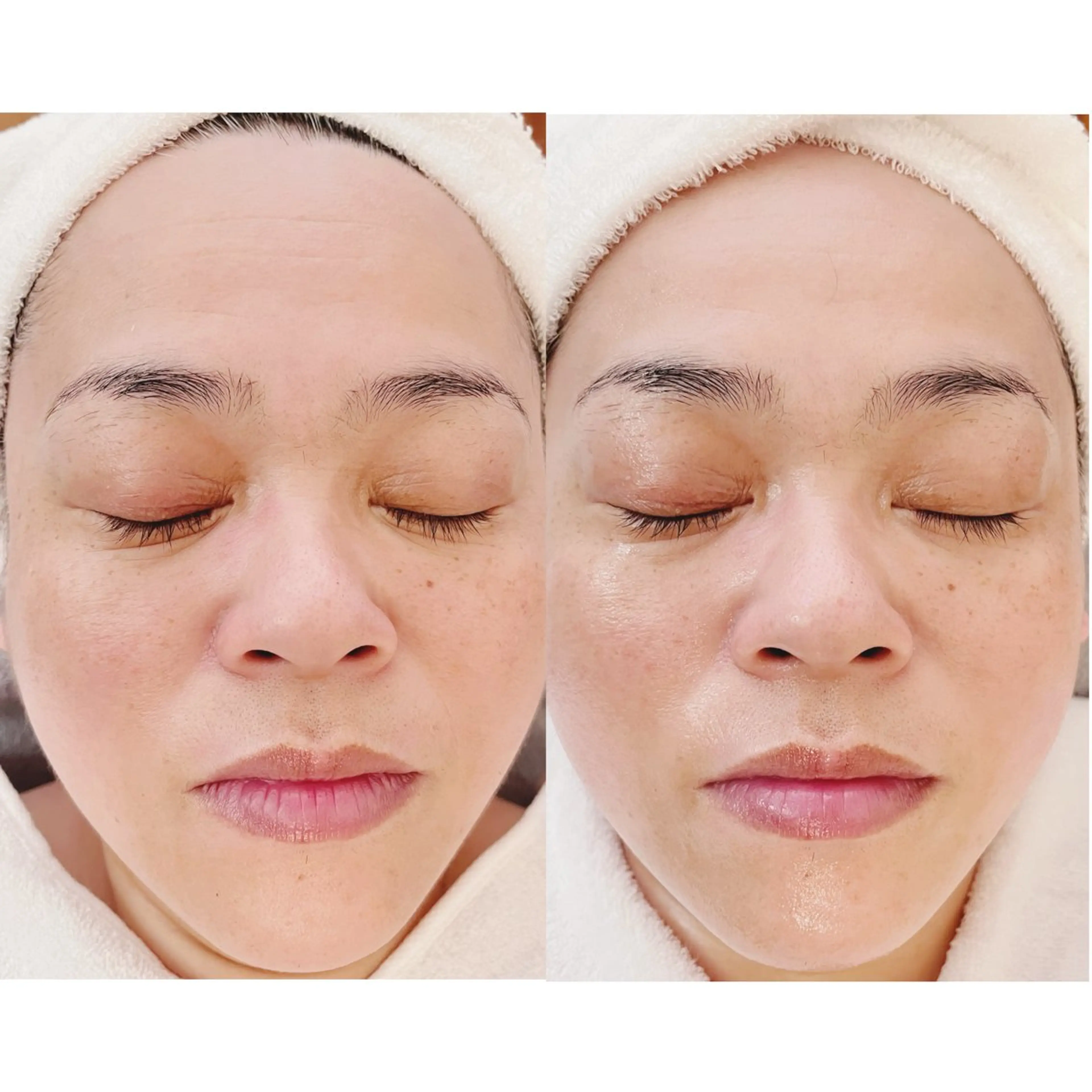 その他 痩身/リンパマッサージ専門サロン　 MOA所属・エステサロンMOA (モア)のエステ・リラクイメージ