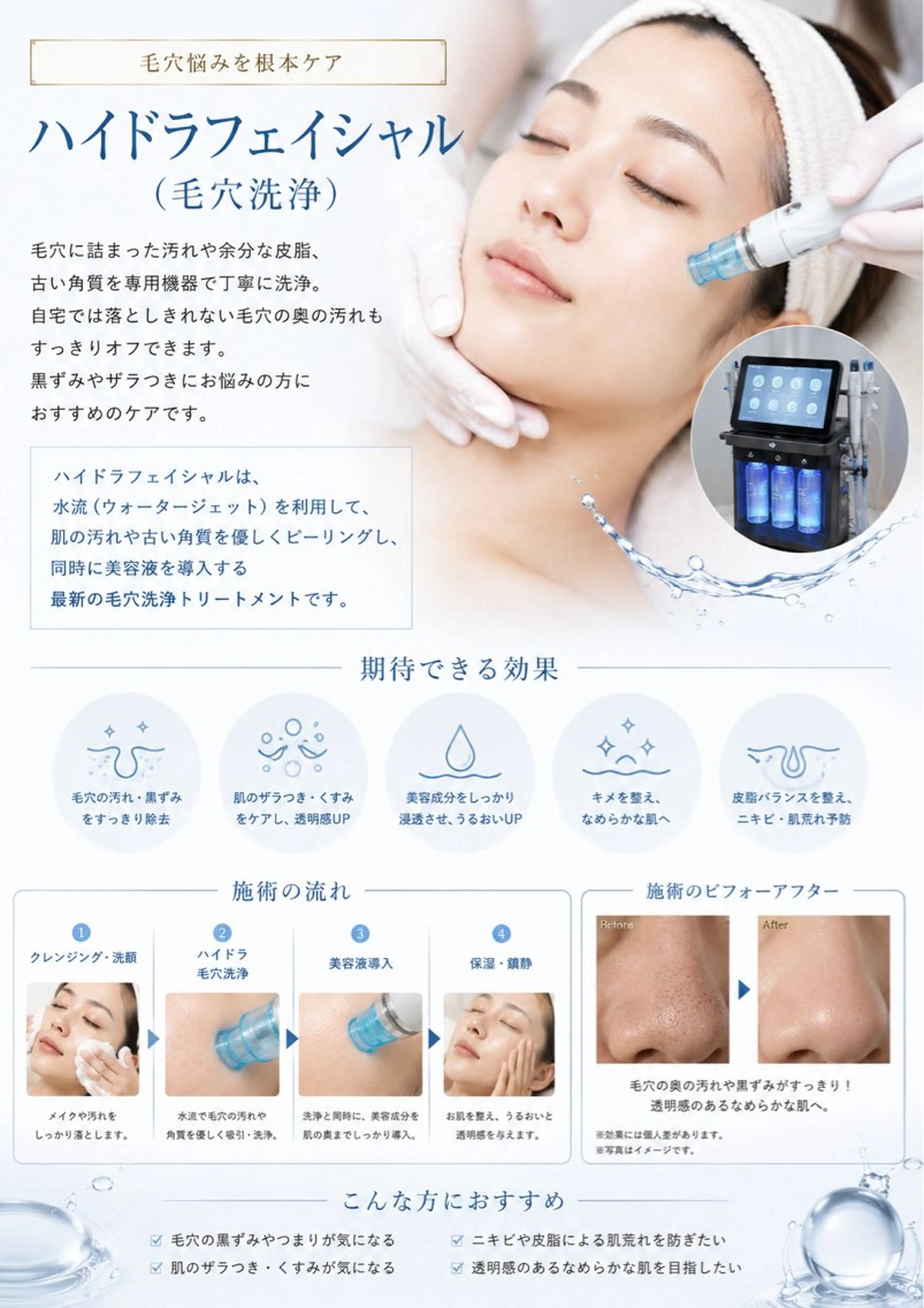 エステ リラク 肌質改善サロン réposのその他イメージ