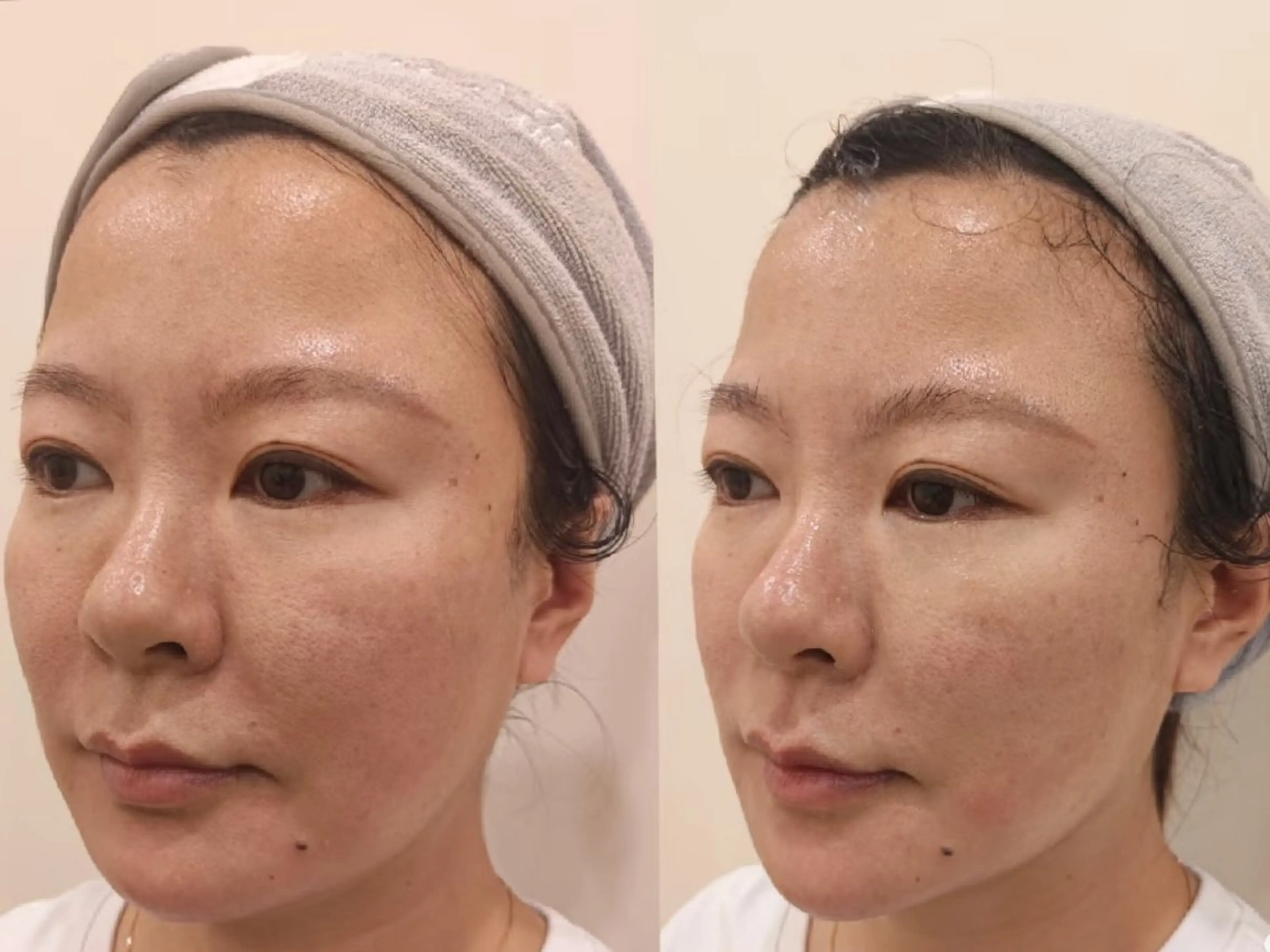 エステ aliaハーブ水光店 エステティシャン募集のエステ・リラクイメージ