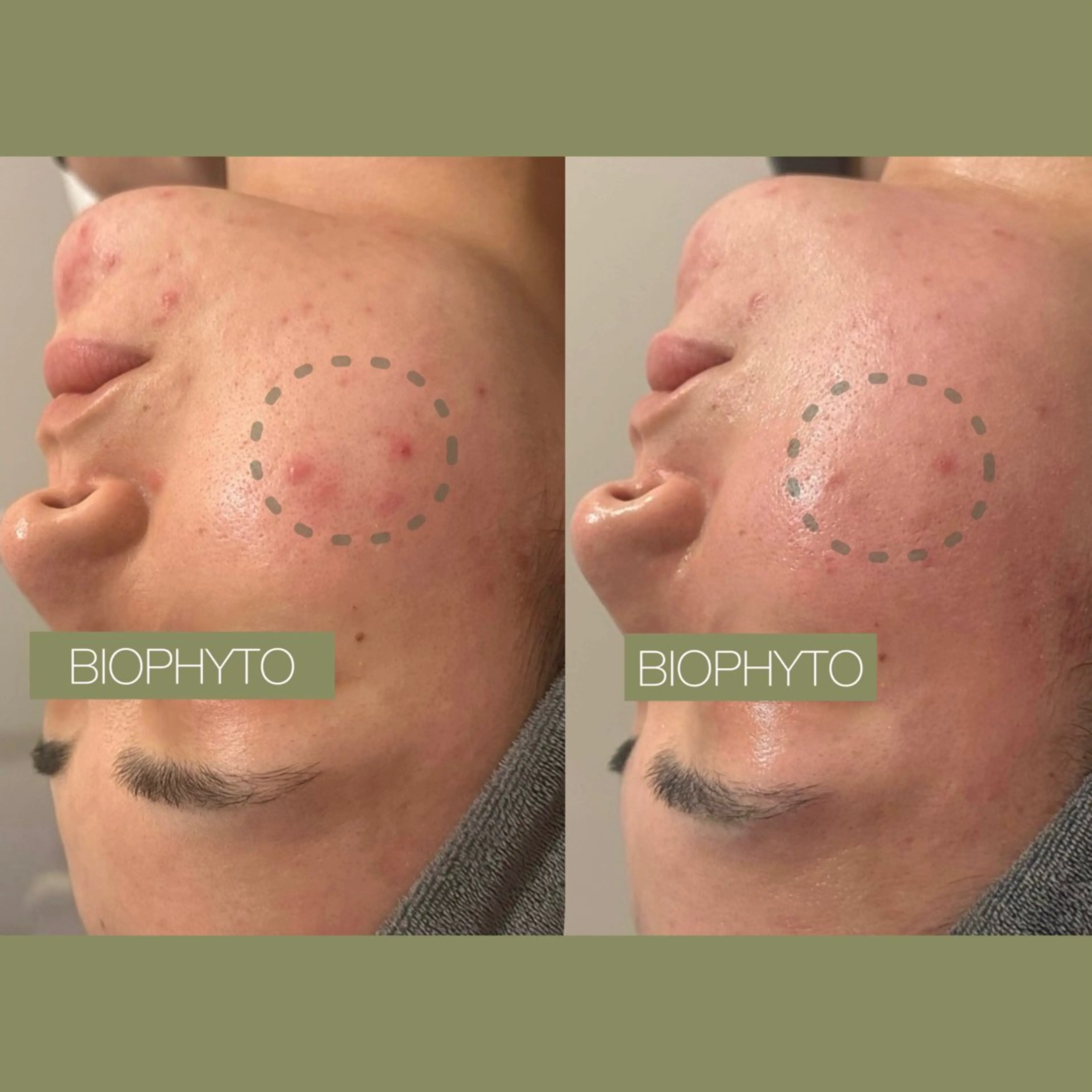 小顔コルギ ☆表参道/外苑前のエステ・リラクイメージ