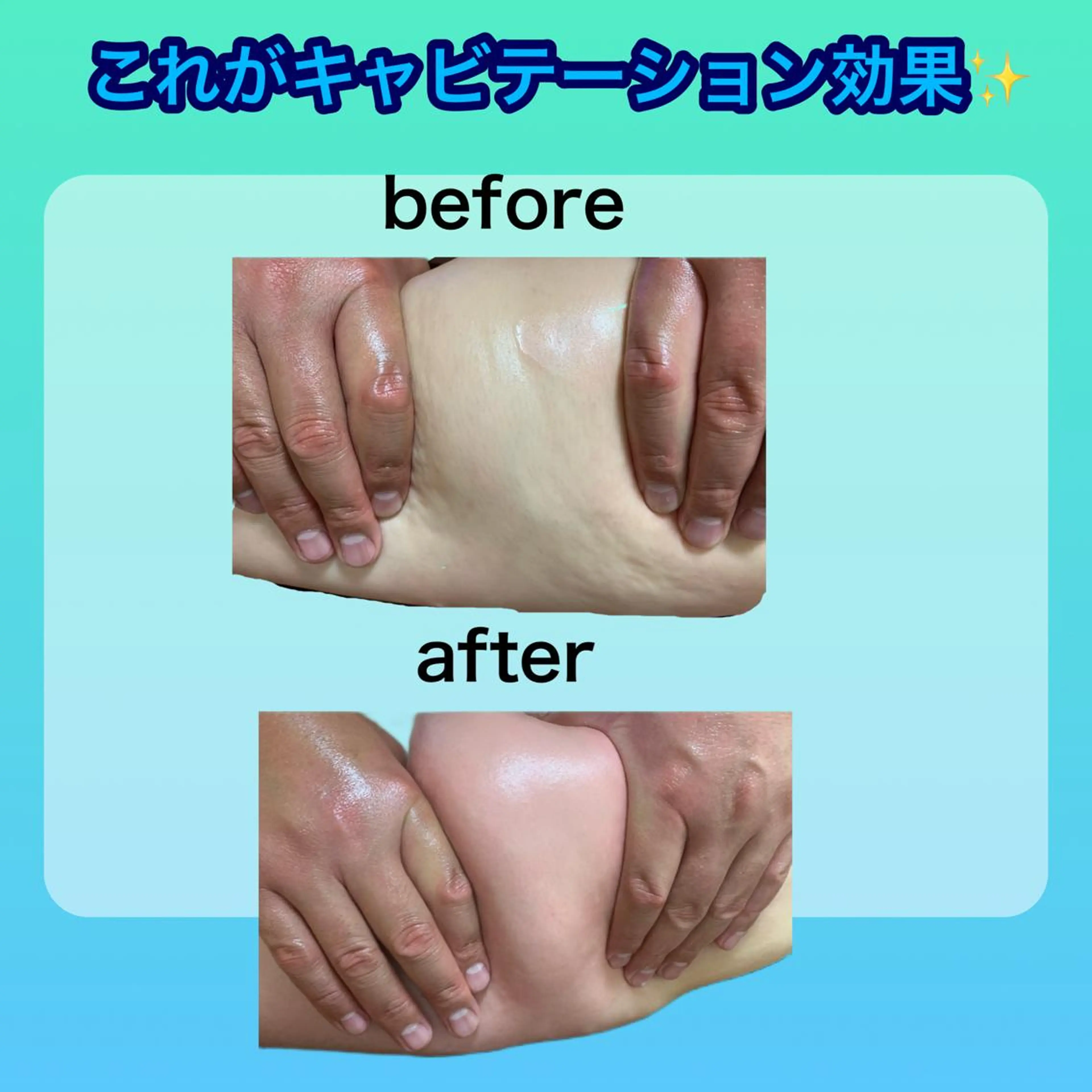 エステ リラク 痩身/脱毛/ネイル HARUKAのエステ・リラクイメージ