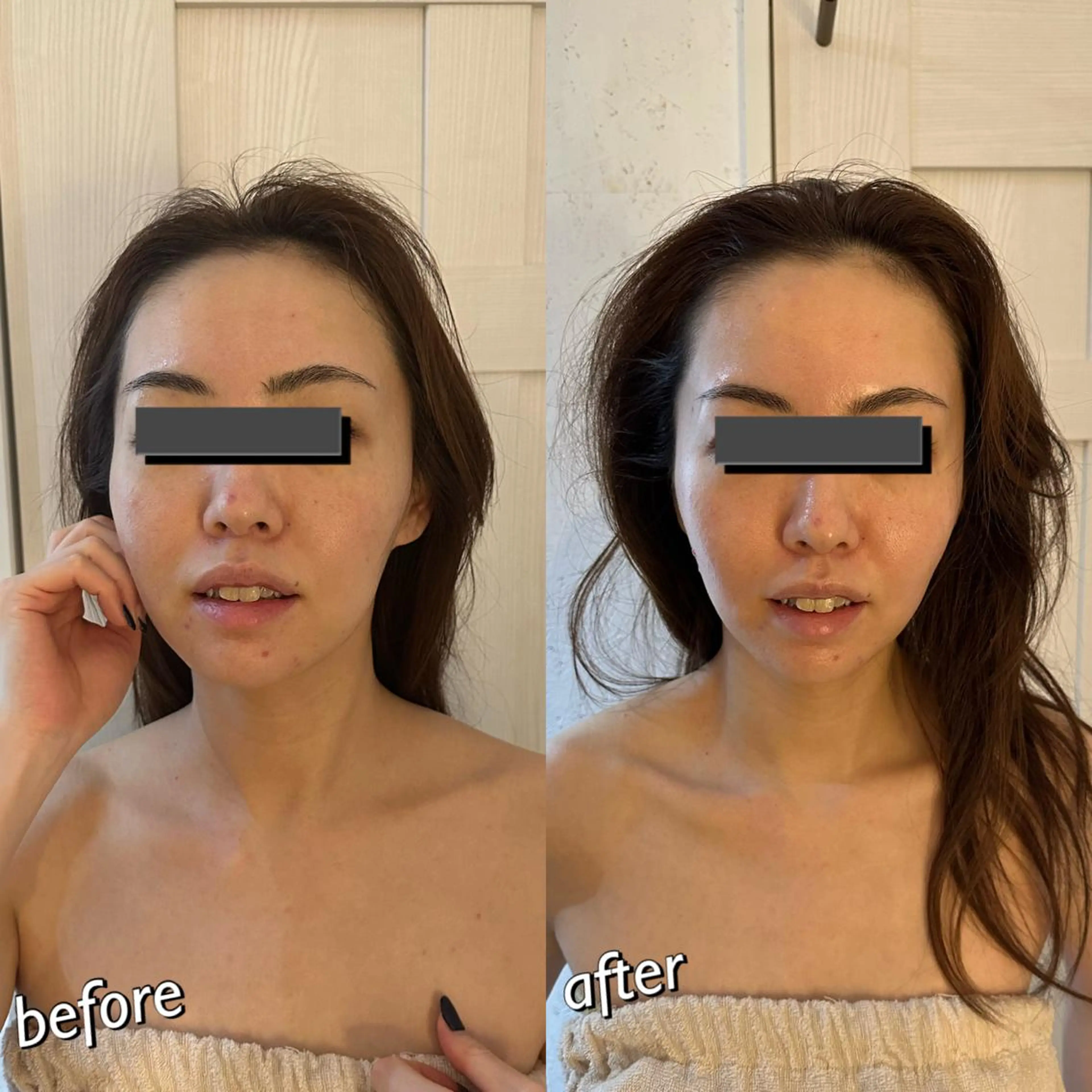 うなじ脱毛/美肌脱毛 LABELのエステ・リラクイメージ