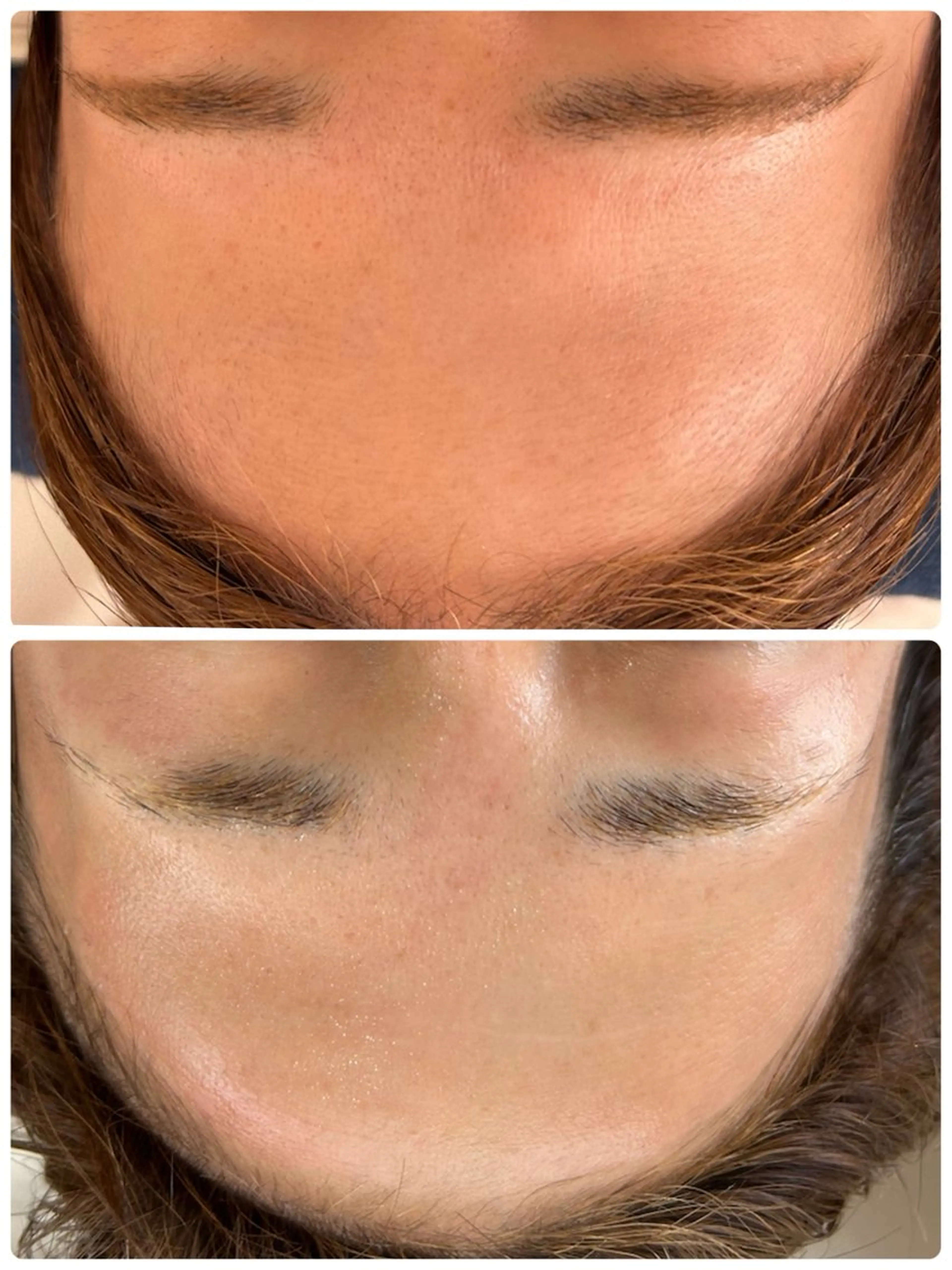 エステ beauty  salon sorelle所属・産毛角質ケア/艶肌 フェイシャルワックスのエステ・リラクイメージ