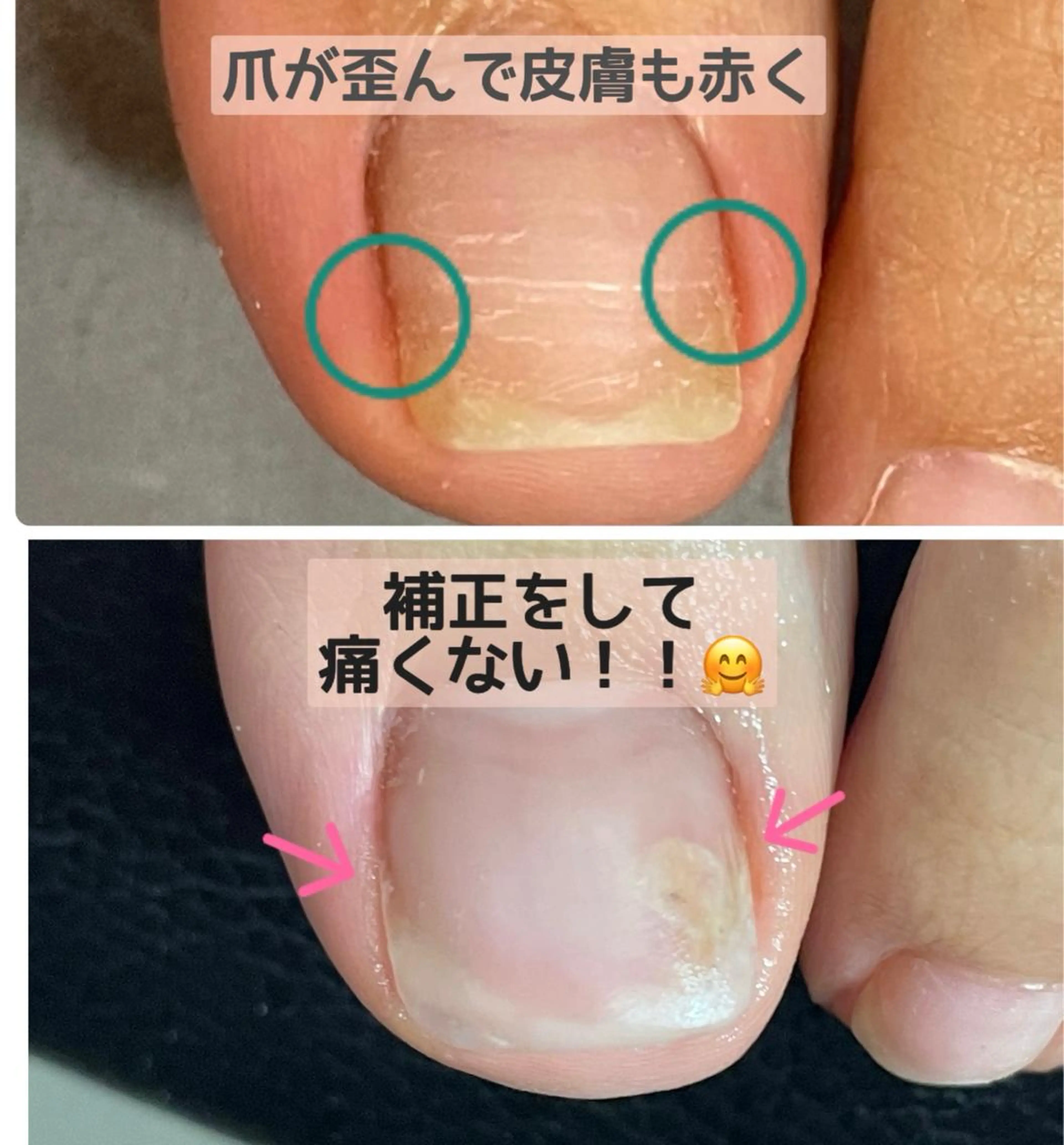 カラー メンズ ネイル Chérinail 爪のお手入れのネイルデザイン