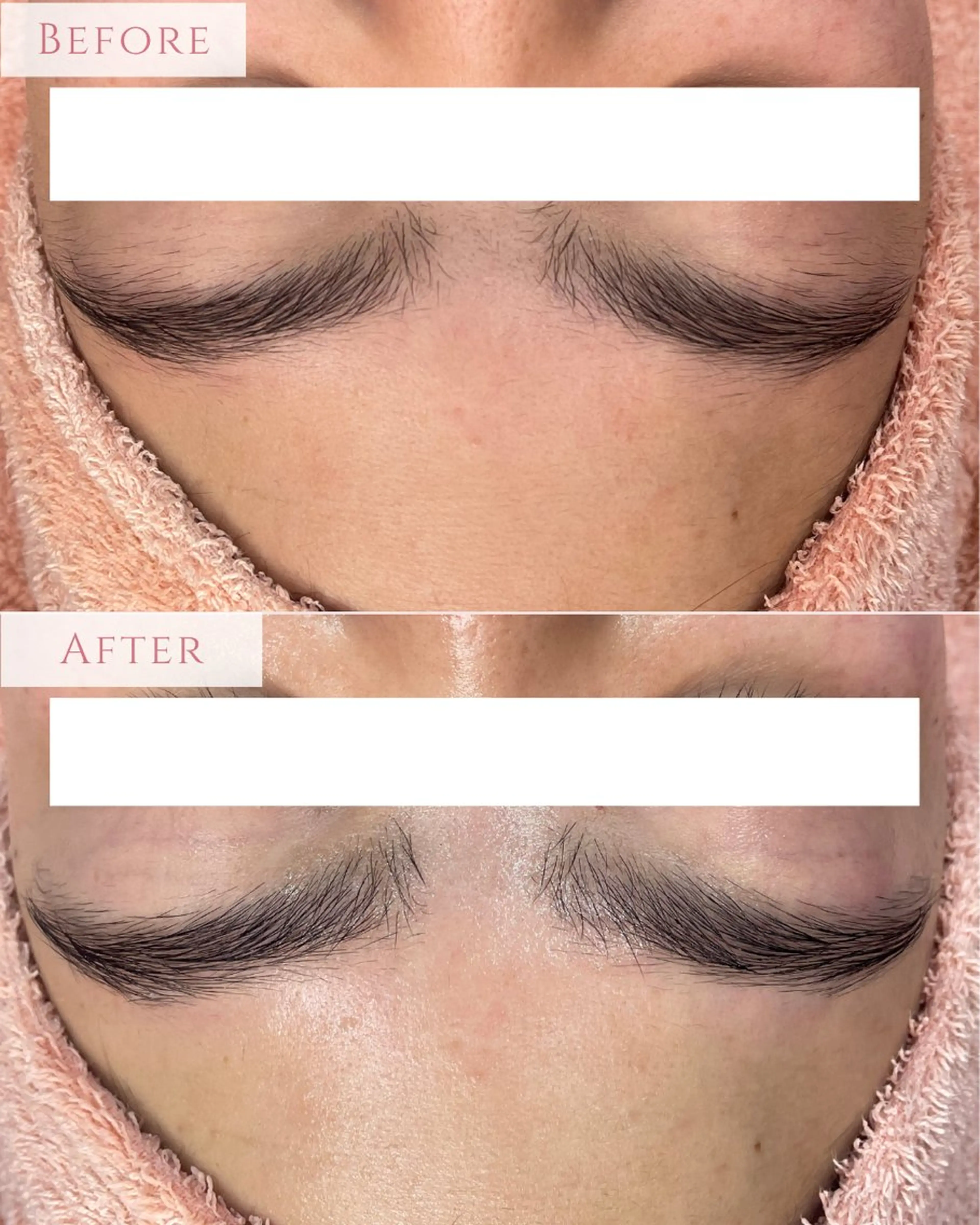 脱毛 肌質改善専門サロン Bellmi/心斎橋のエステ・リラクイメージ