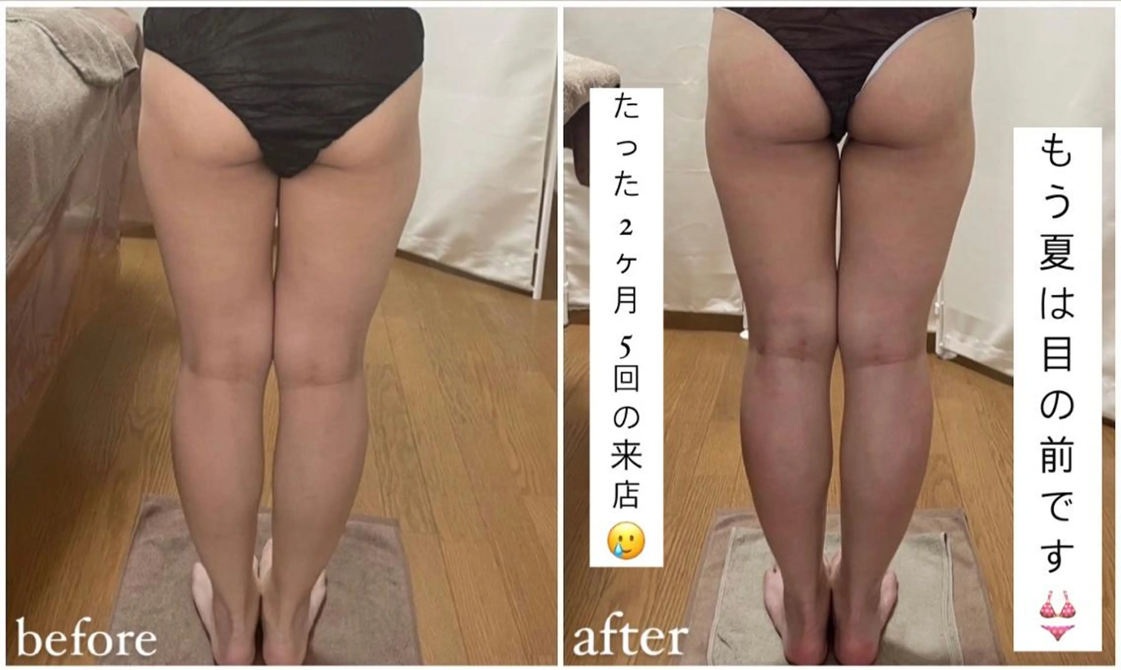 《本気痩せ×疲労改善 》  BILOOPのエステ・リラクイメージ