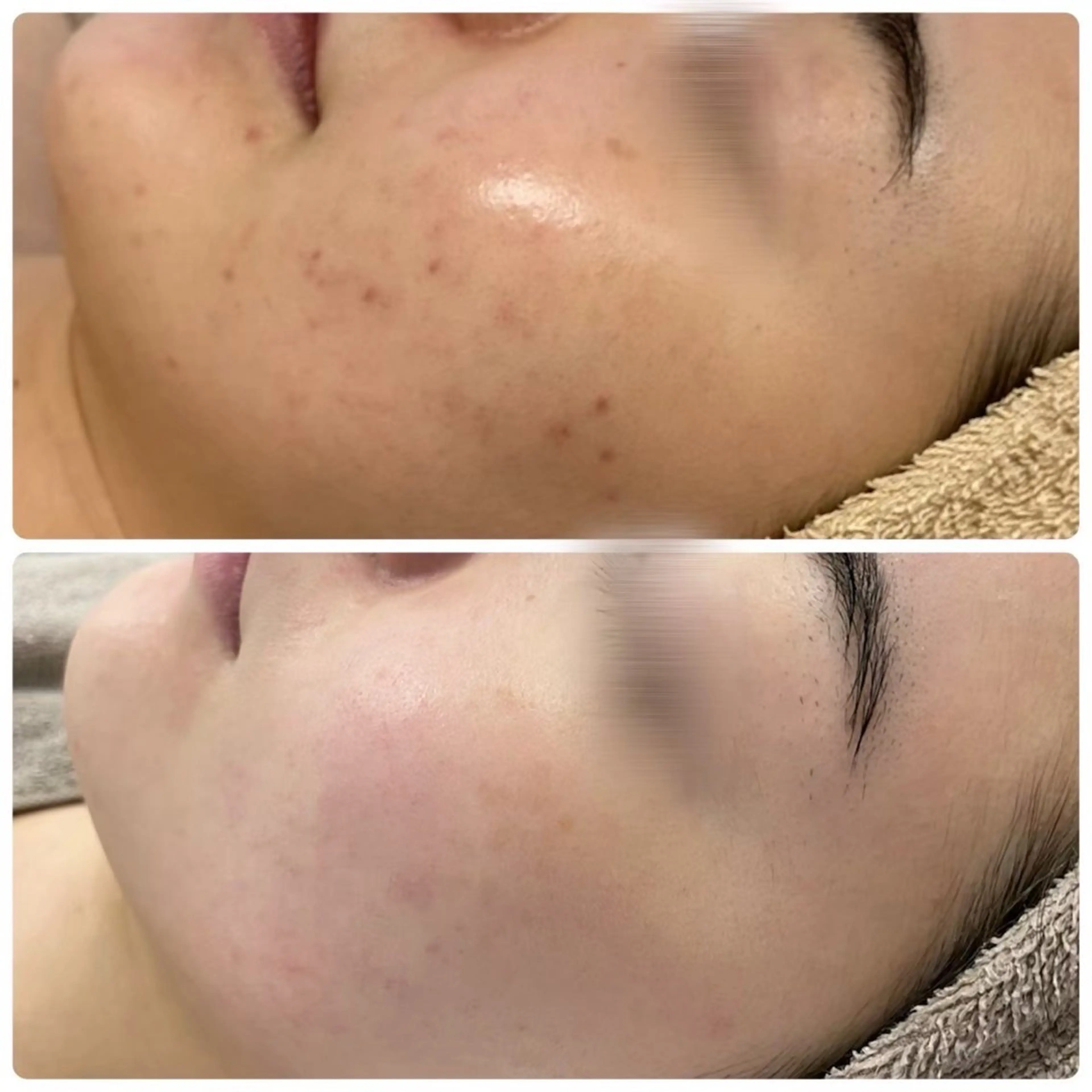 エステ 小顔×痩身専門サロンCLORE浦和店所属・石川 彩花のエステ・リラクイメージ