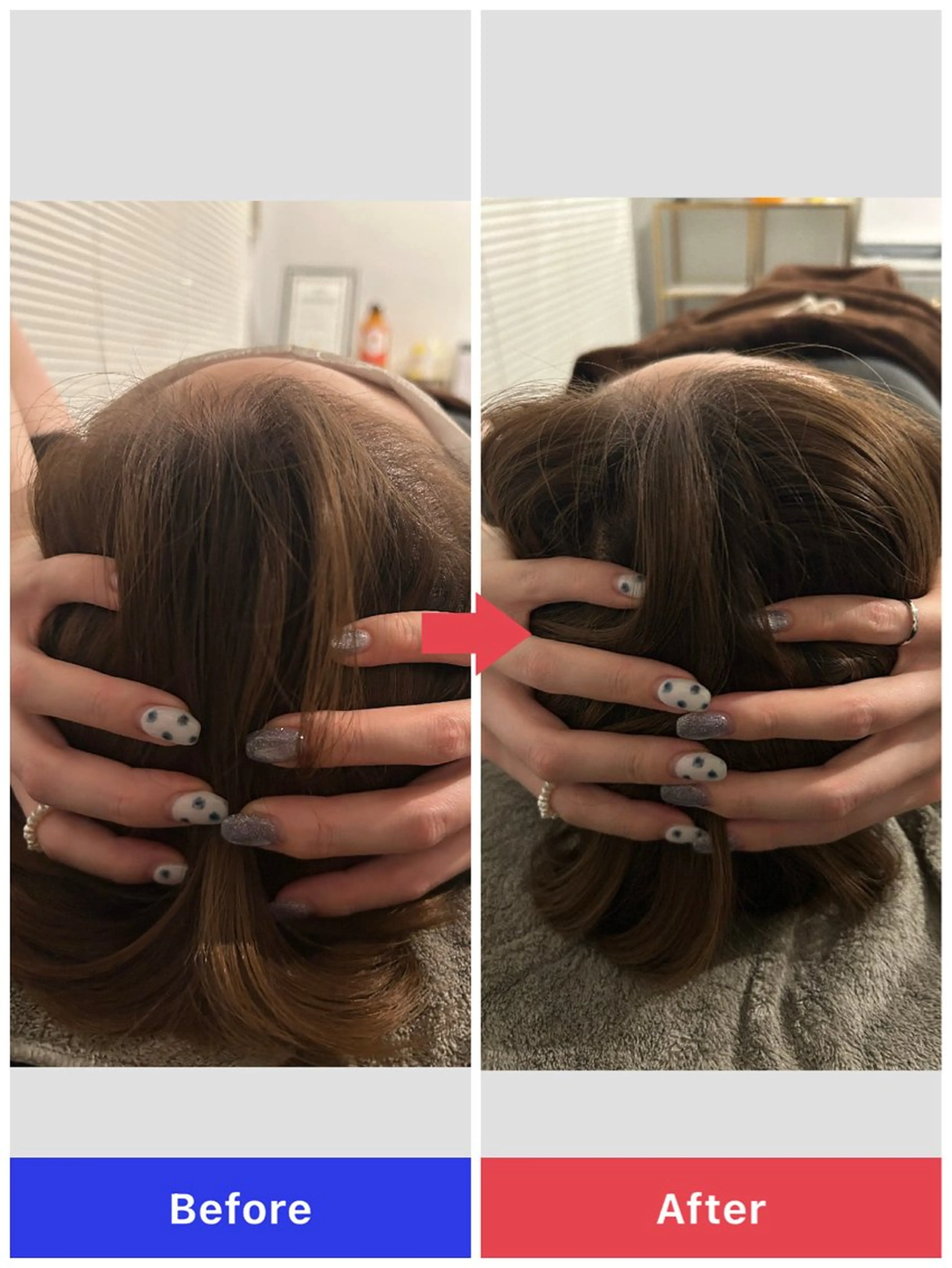 小顔矯正特化スパの写真