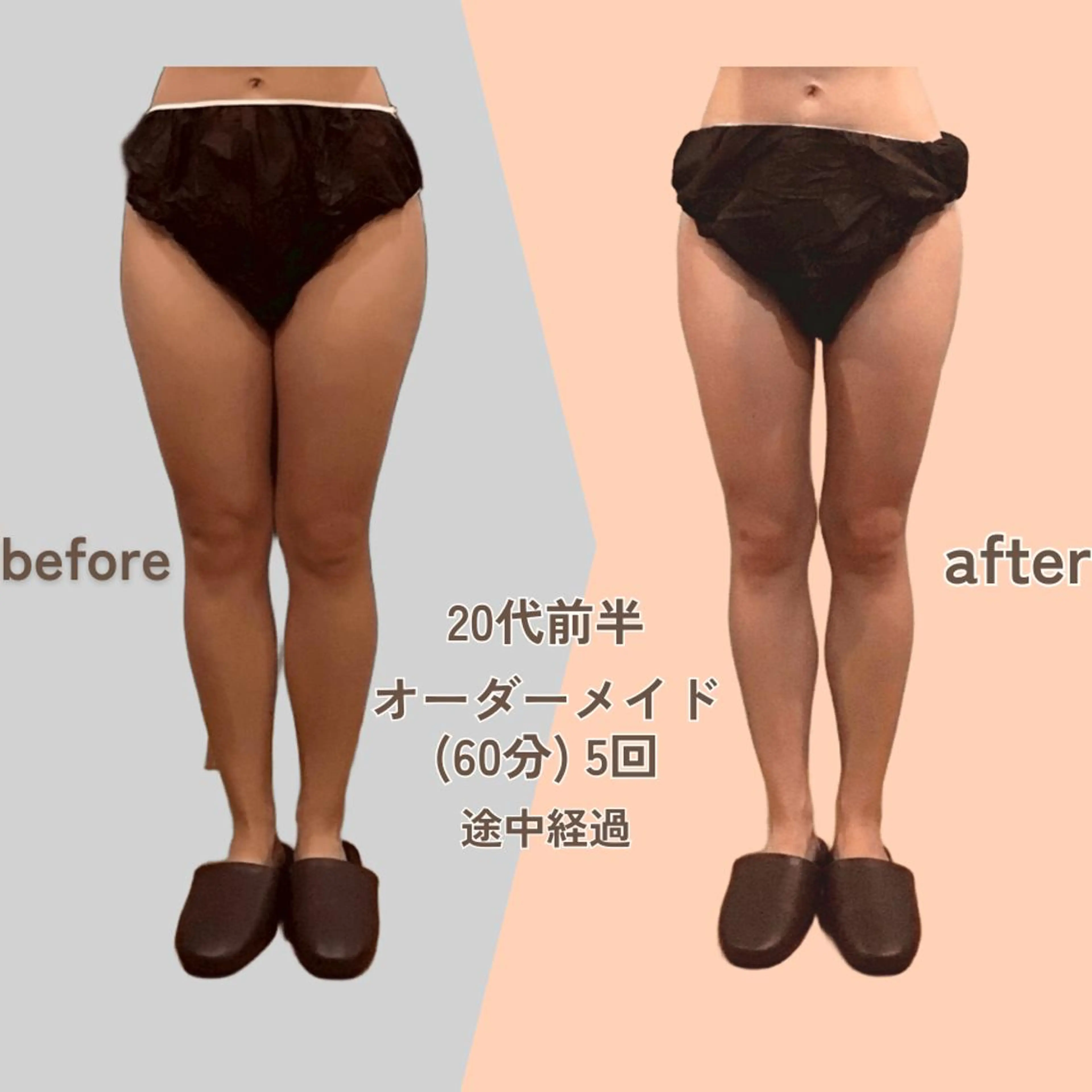 痩身エステ Julien麹町店のエステ・リラクイメージ