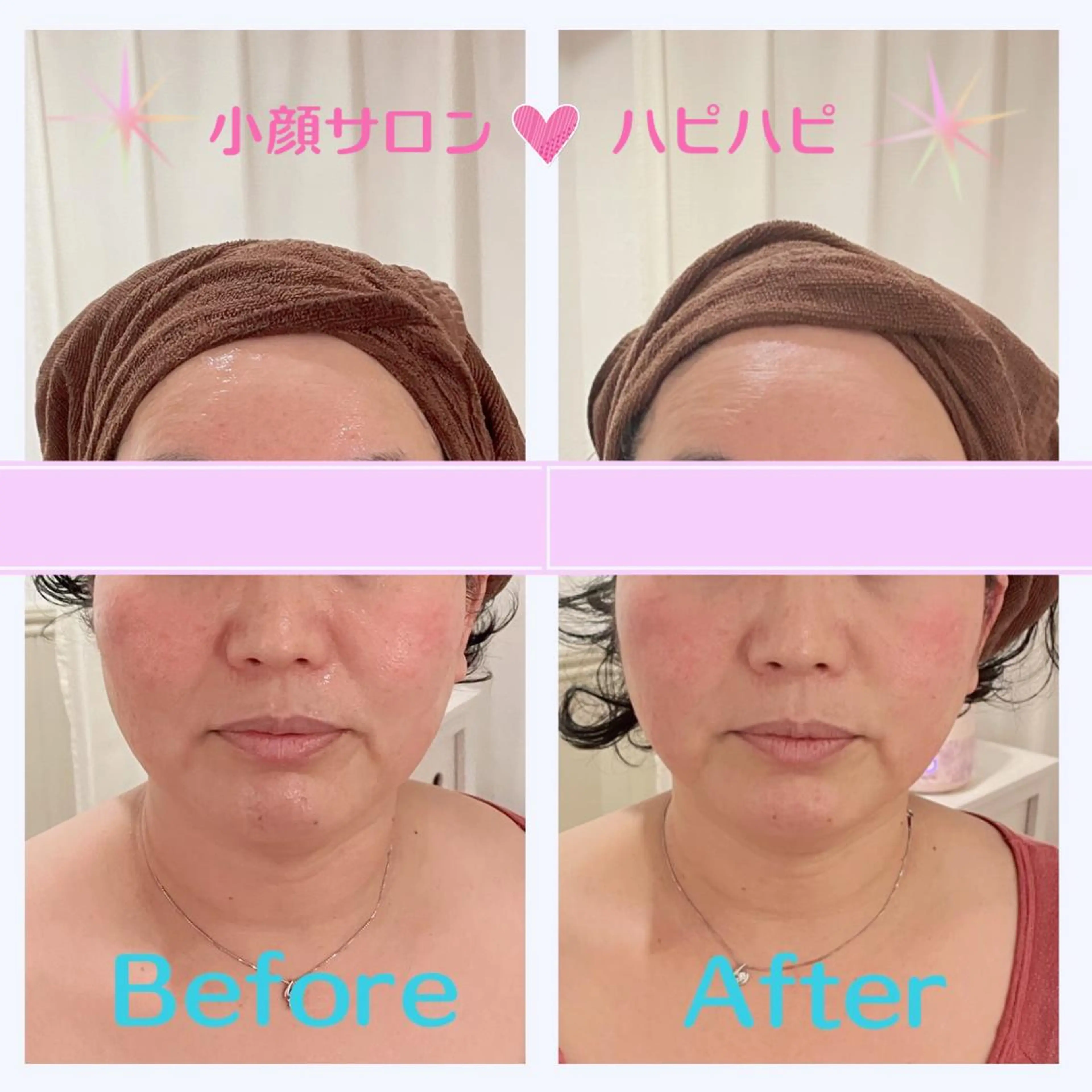 小顔エステサロン ハピハピのエステ・リラクイメージ