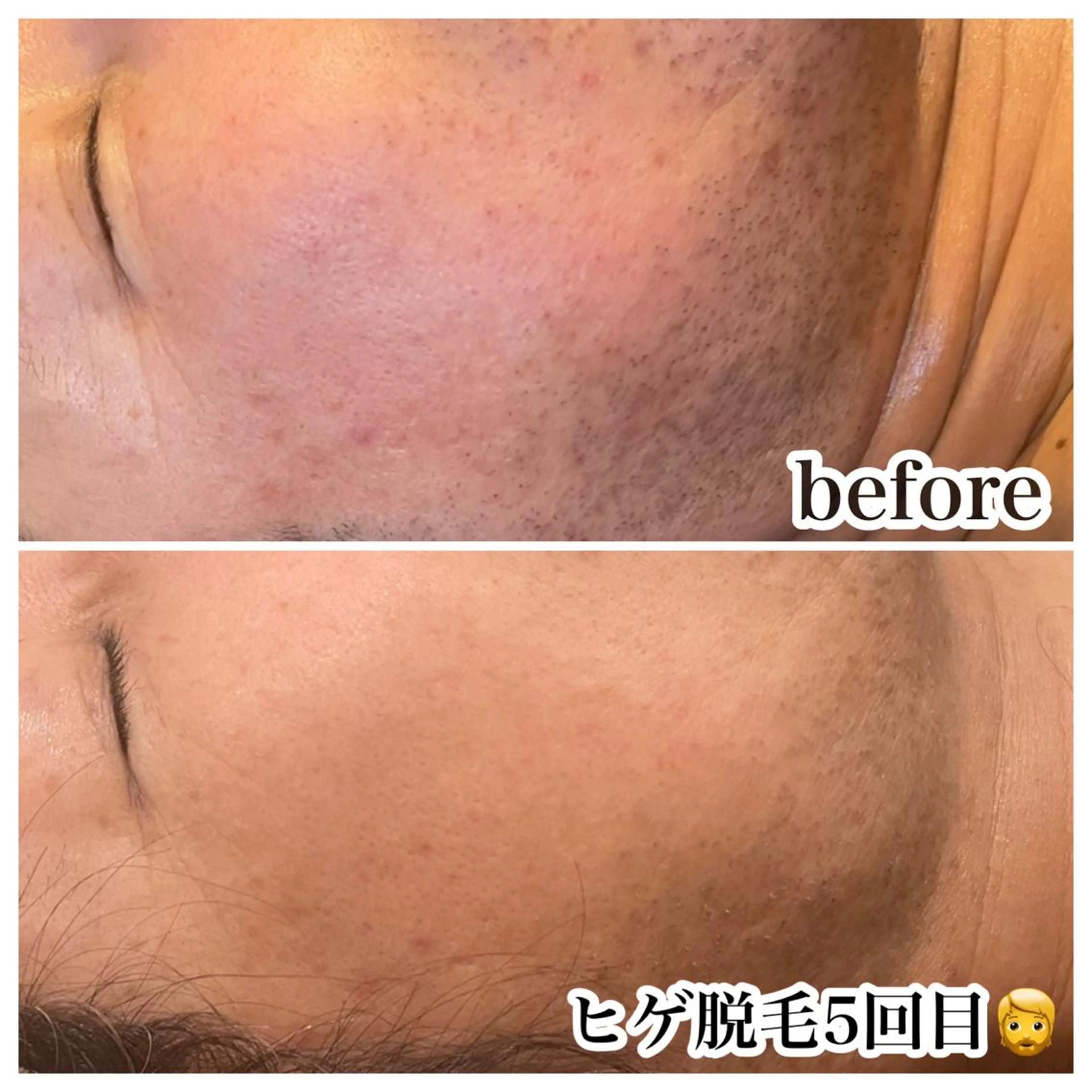 脱毛 浜野 恵美のエステ・リラクイメージ