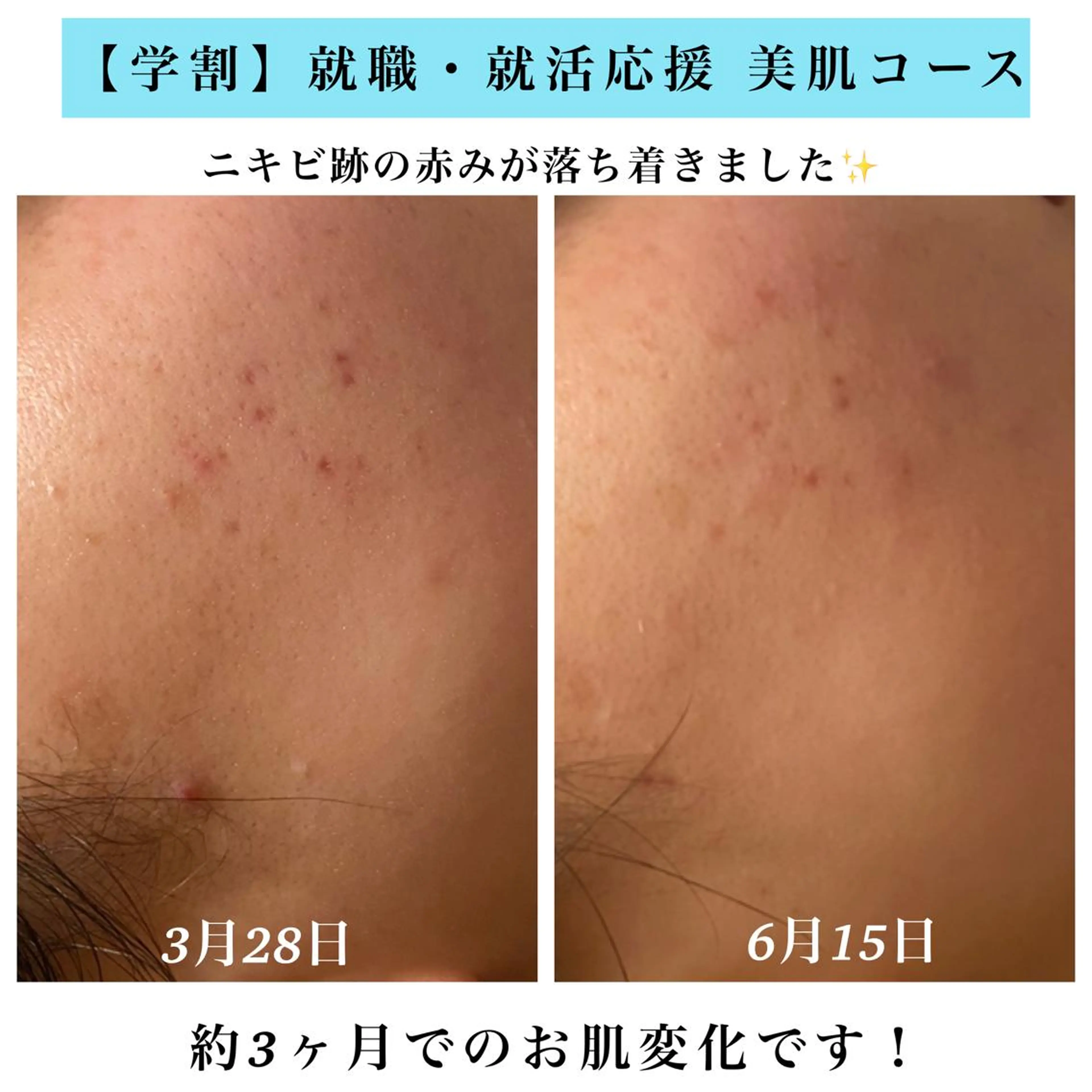 エステ Bellesthe （ベルエステ）のエステ・リラクイメージ