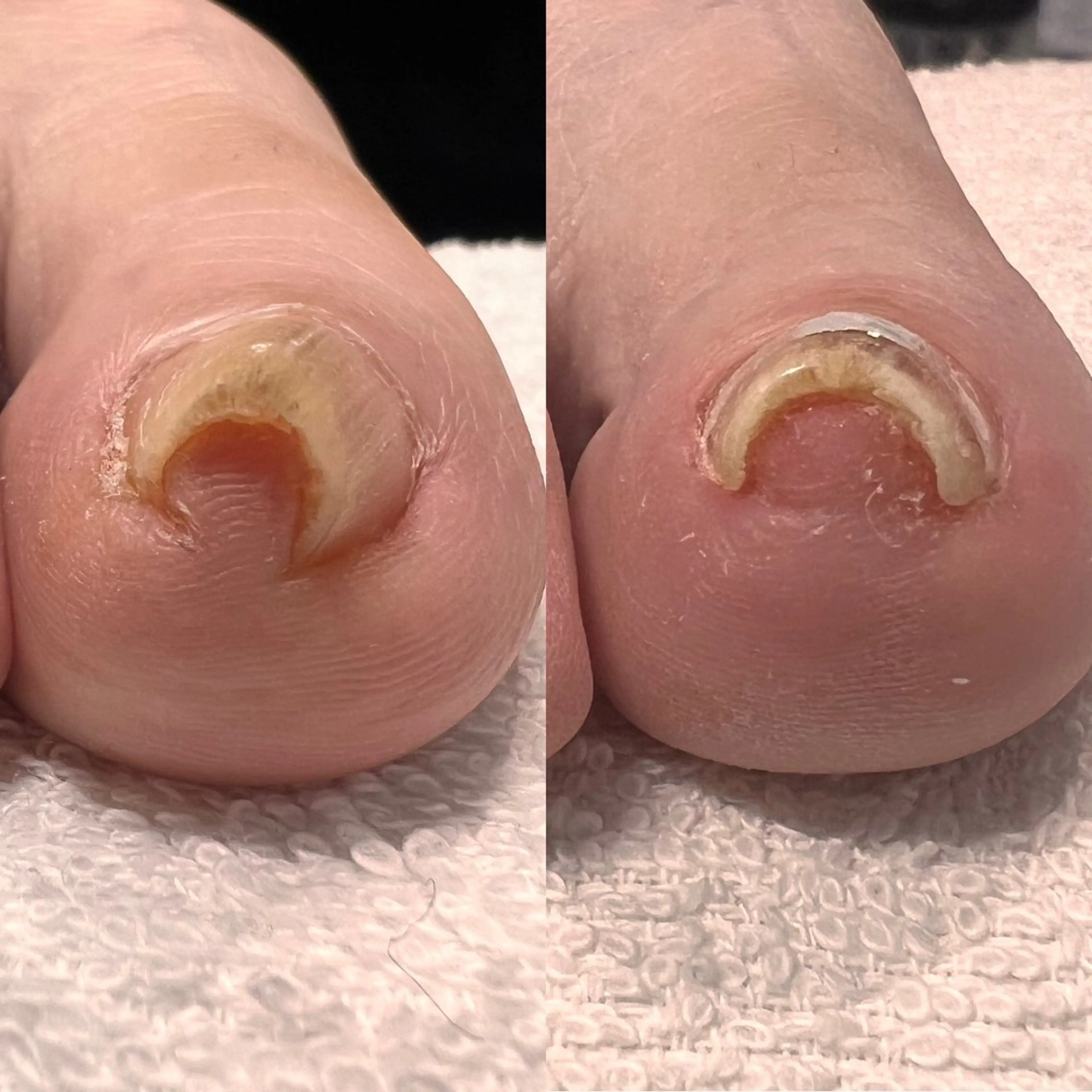 ネイル フットネイル 毛穴改善/脱毛 ネイル　川上久仁子のエステ・リラクイメージ