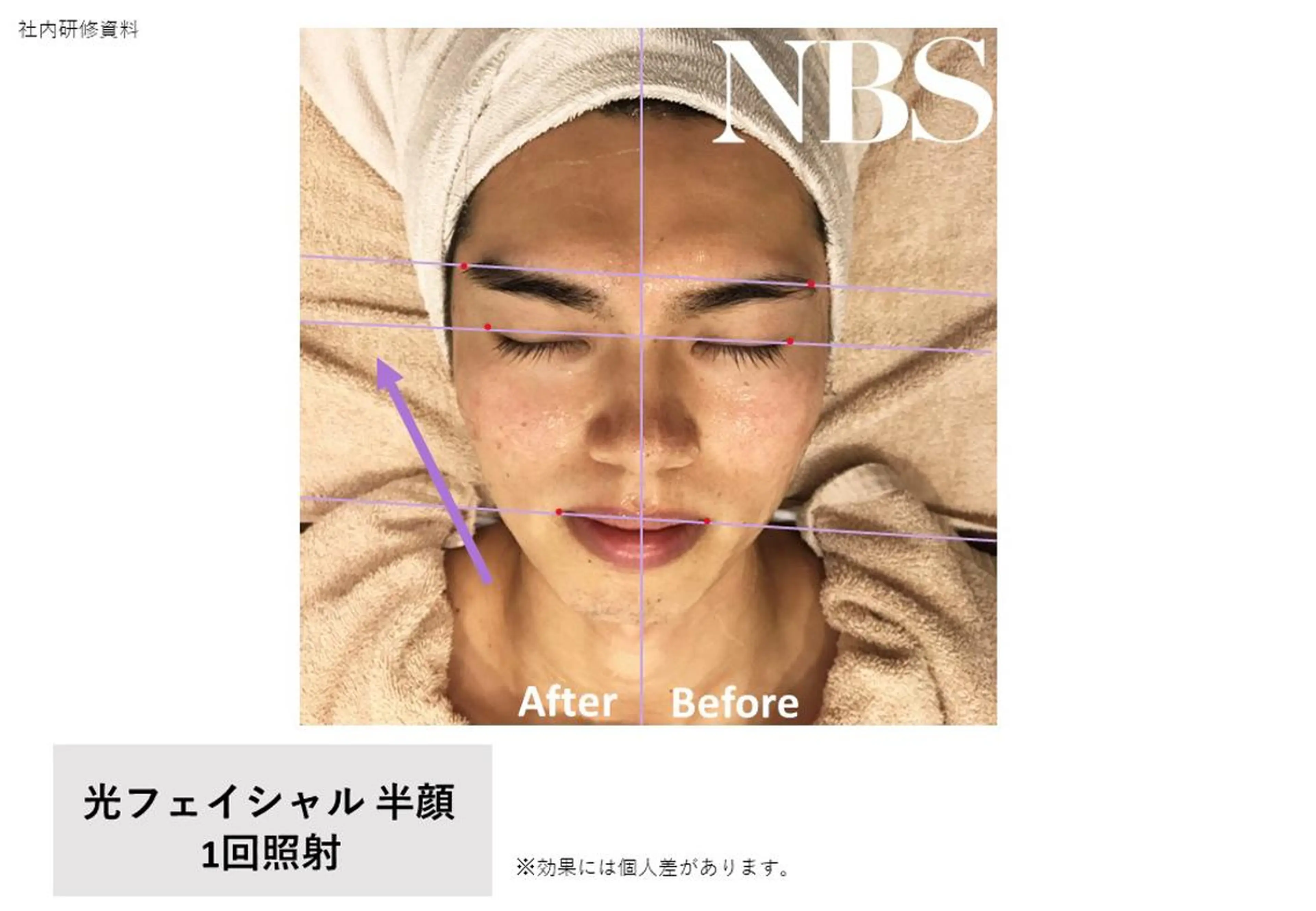 メンズ 痩身・脱毛・美髪ケア 【GLYCINE】のエステ・リラクイメージ