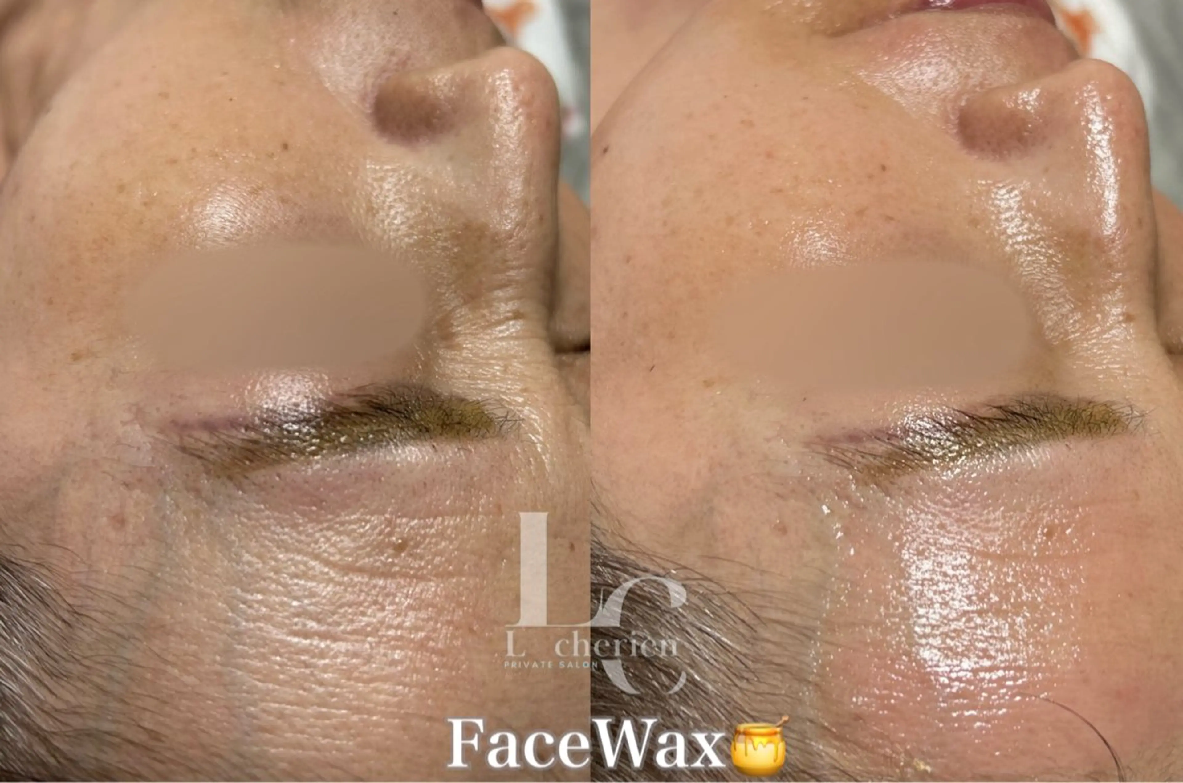 脱毛 Le cherienのエステ・リラクイメージ