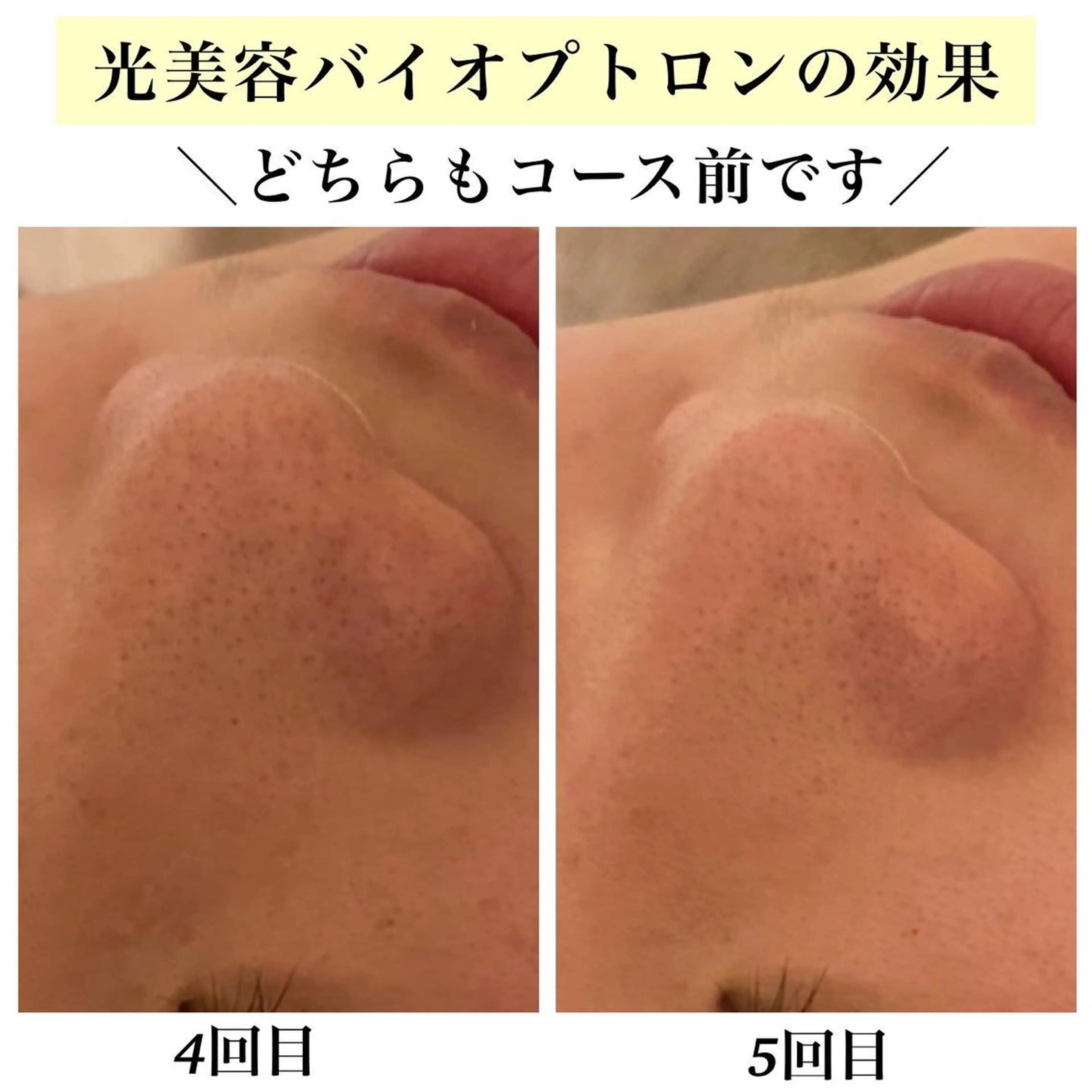 エステ リラク Bellesthe （ベルエステ）のエステ・リラクイメージ