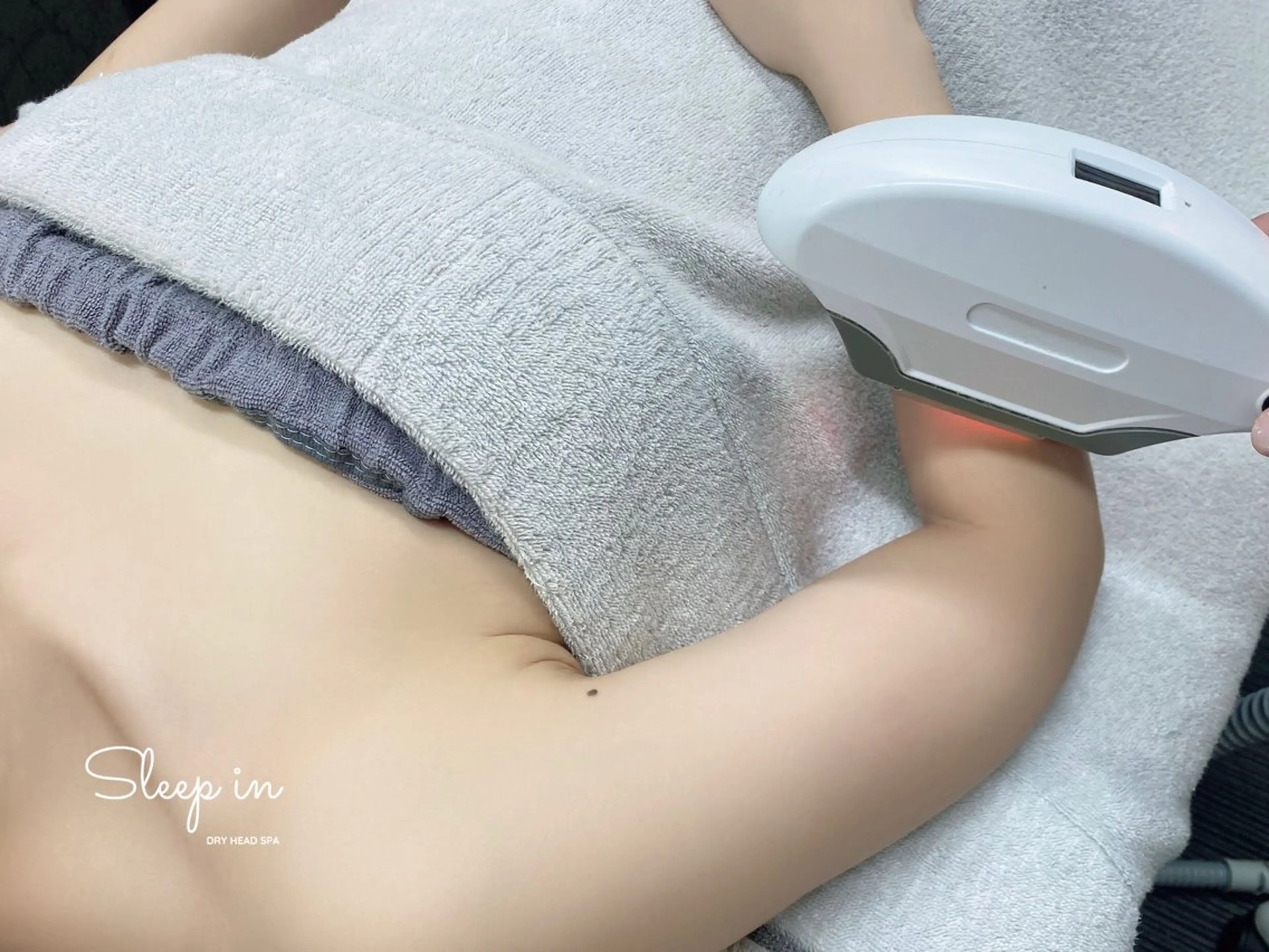全身脱毛【VIO&フェイス含む】 1回7000円の写真