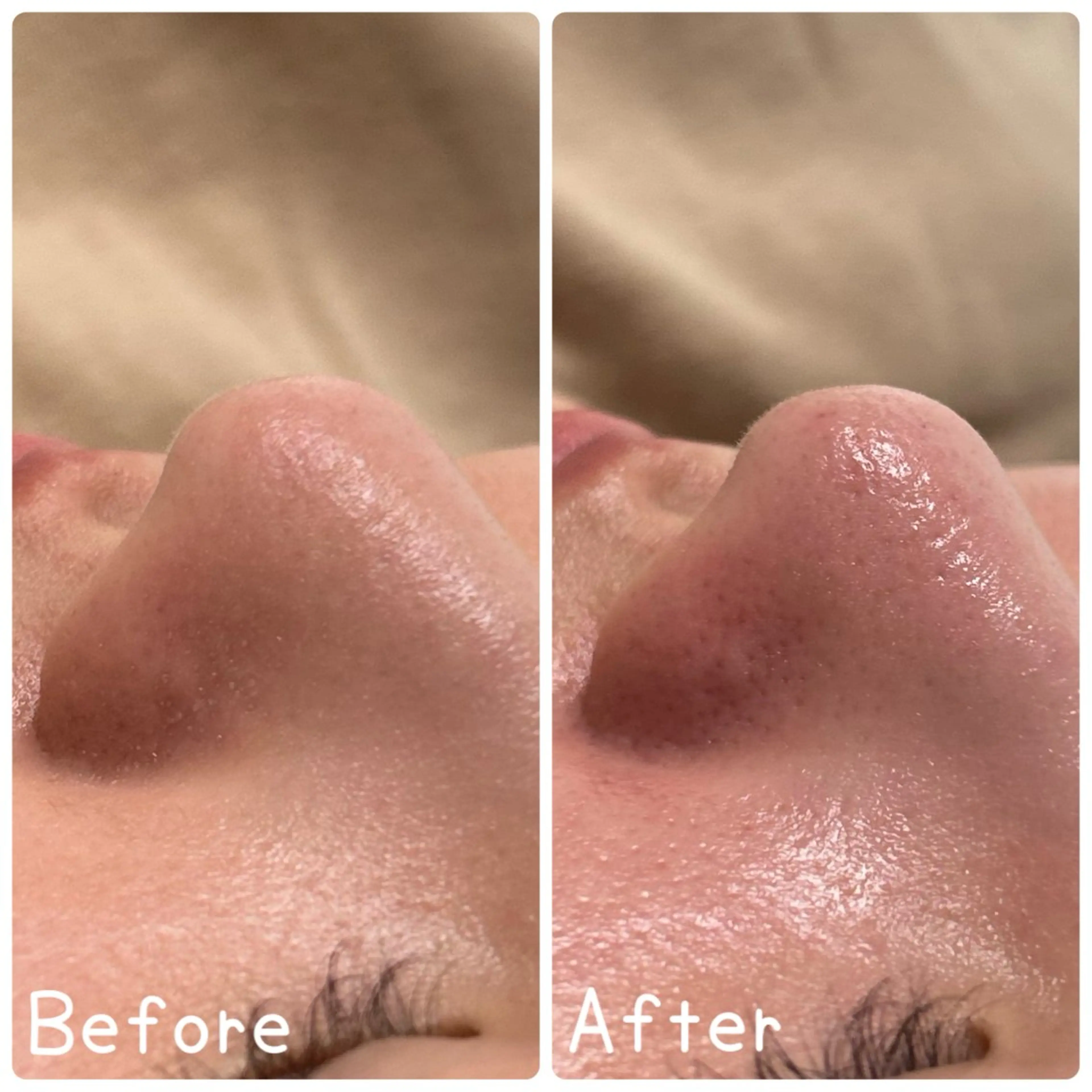 エステ リラク 鍼灸•マッサージサロンCalfa所属・《美肌･小顔》美容鍼 ＆マッサージ＊MEIのエステ・リラクイメージ