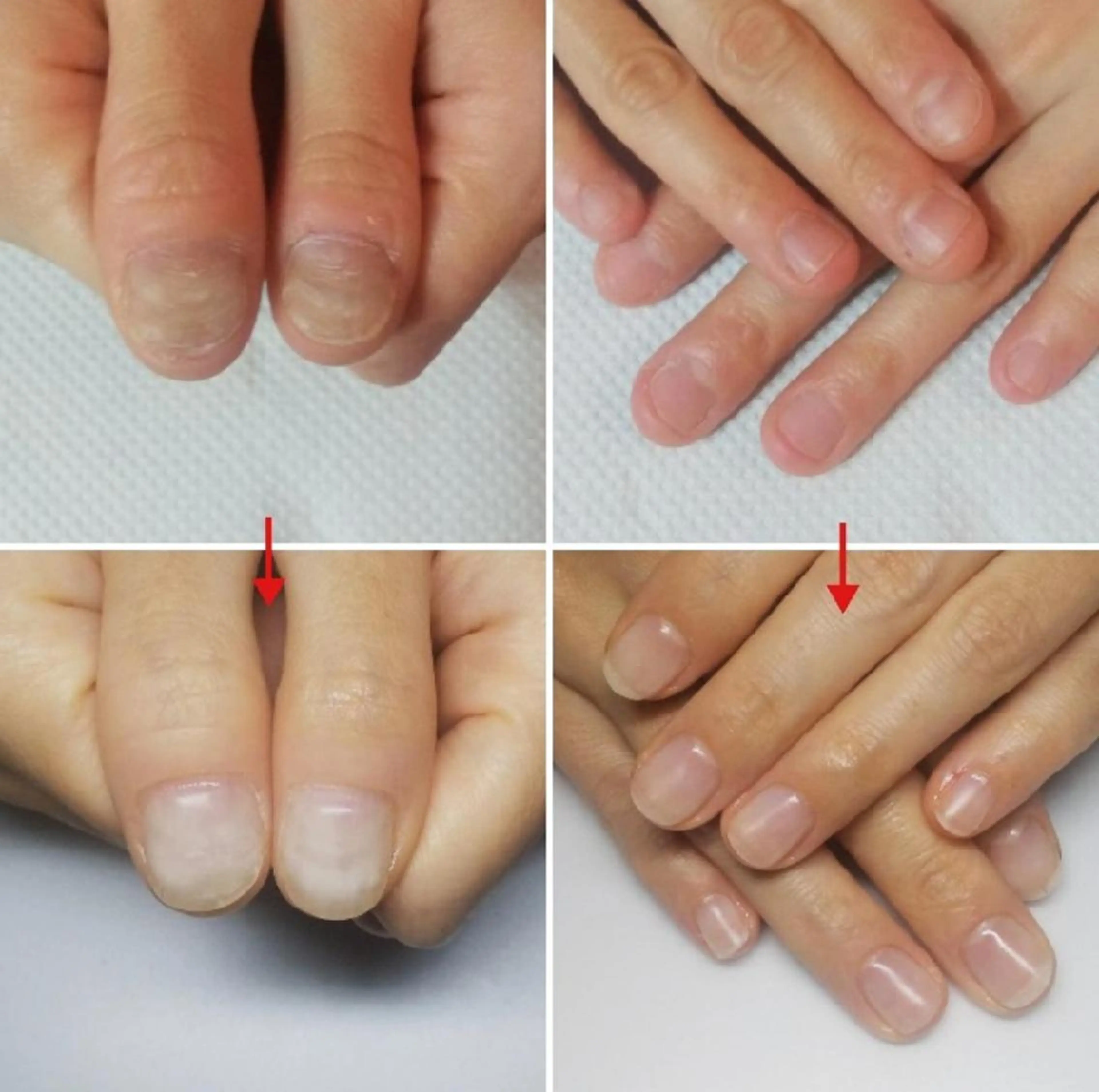 ネイル ネイルサロン アリュームのネイルデザイン