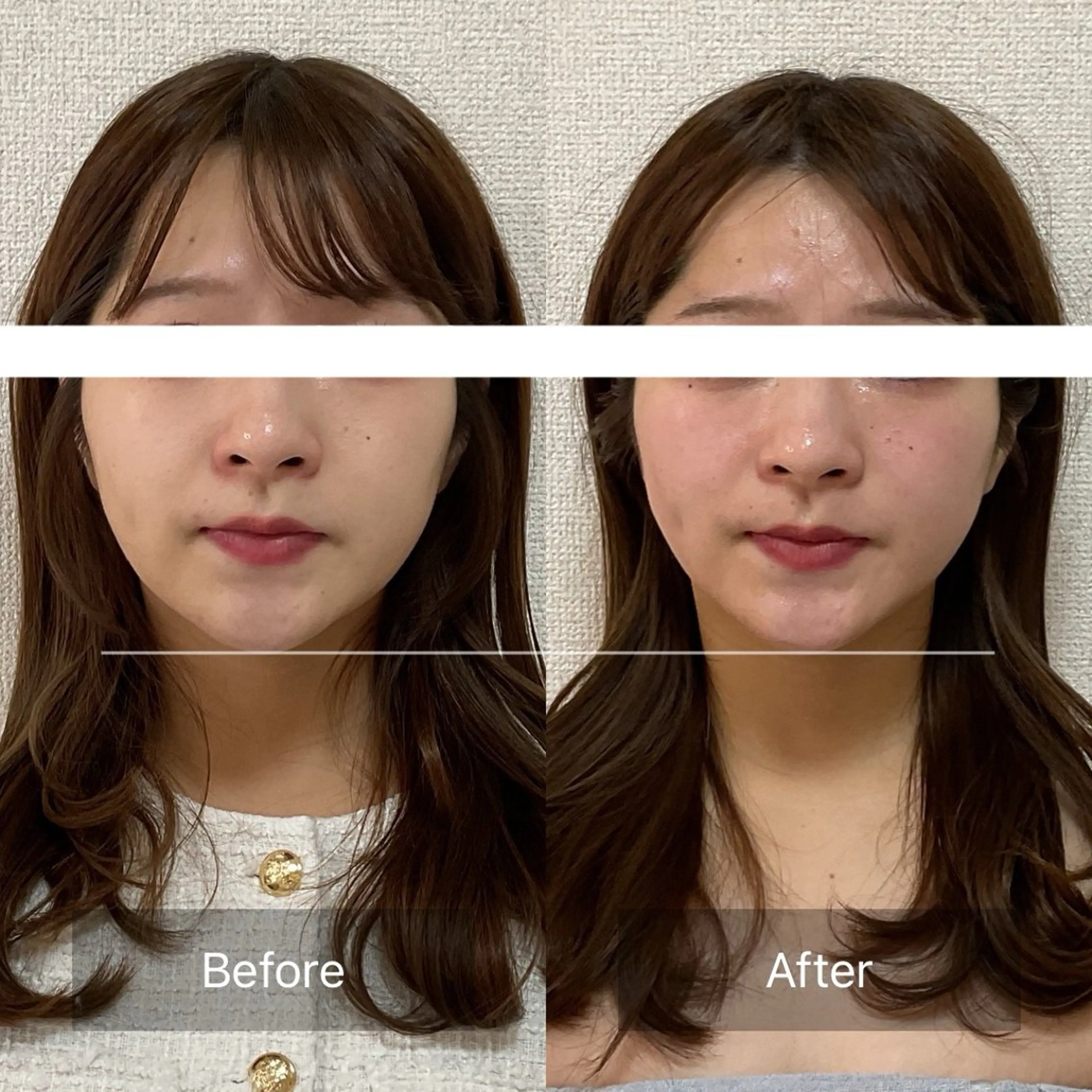 小顔×肌質改善 《お顔の印象》のエステ・リラクイメージ