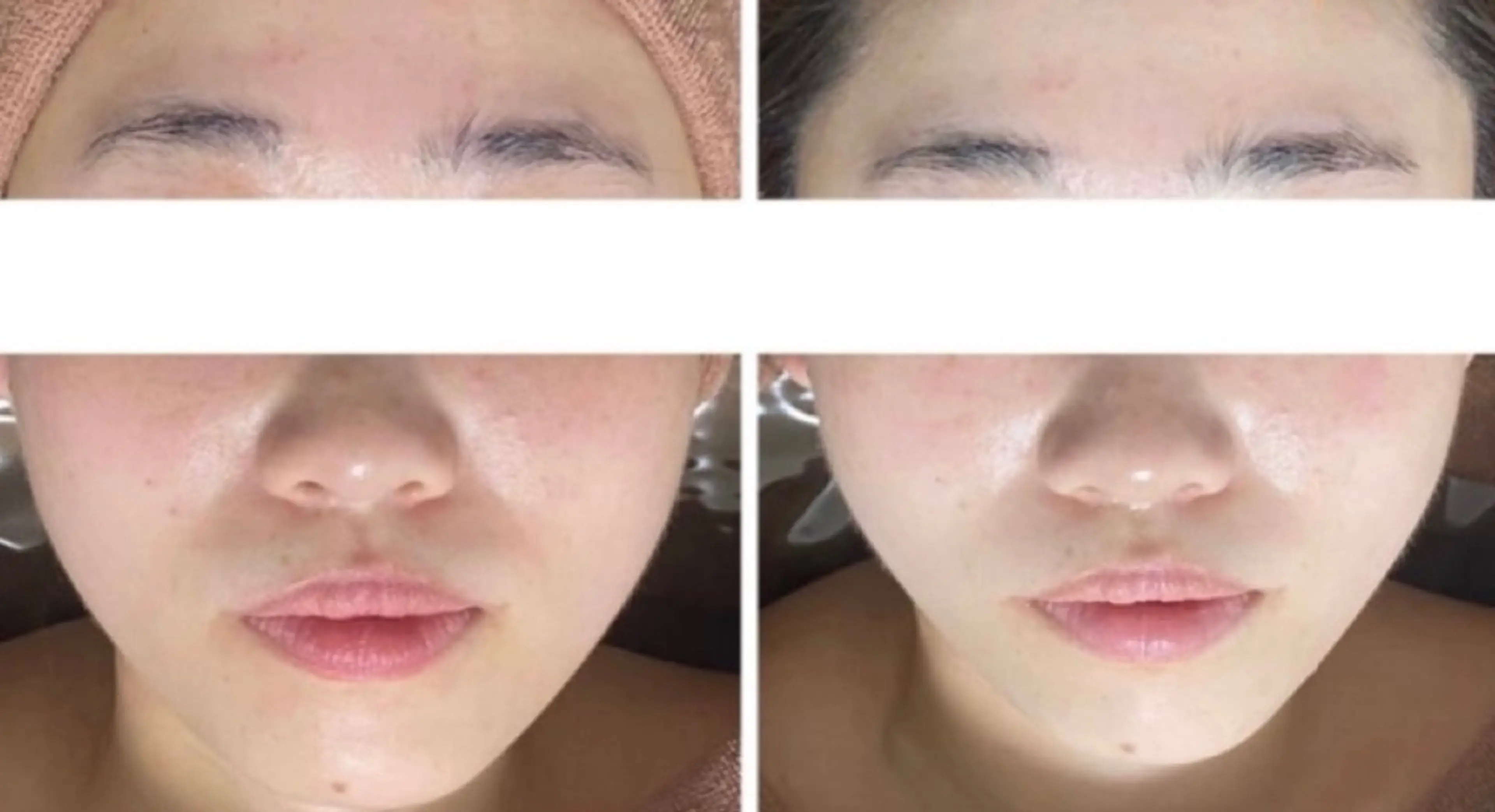 中目黒ハーブピーリン グ🌿ララピールのエステ・リラクイメージ