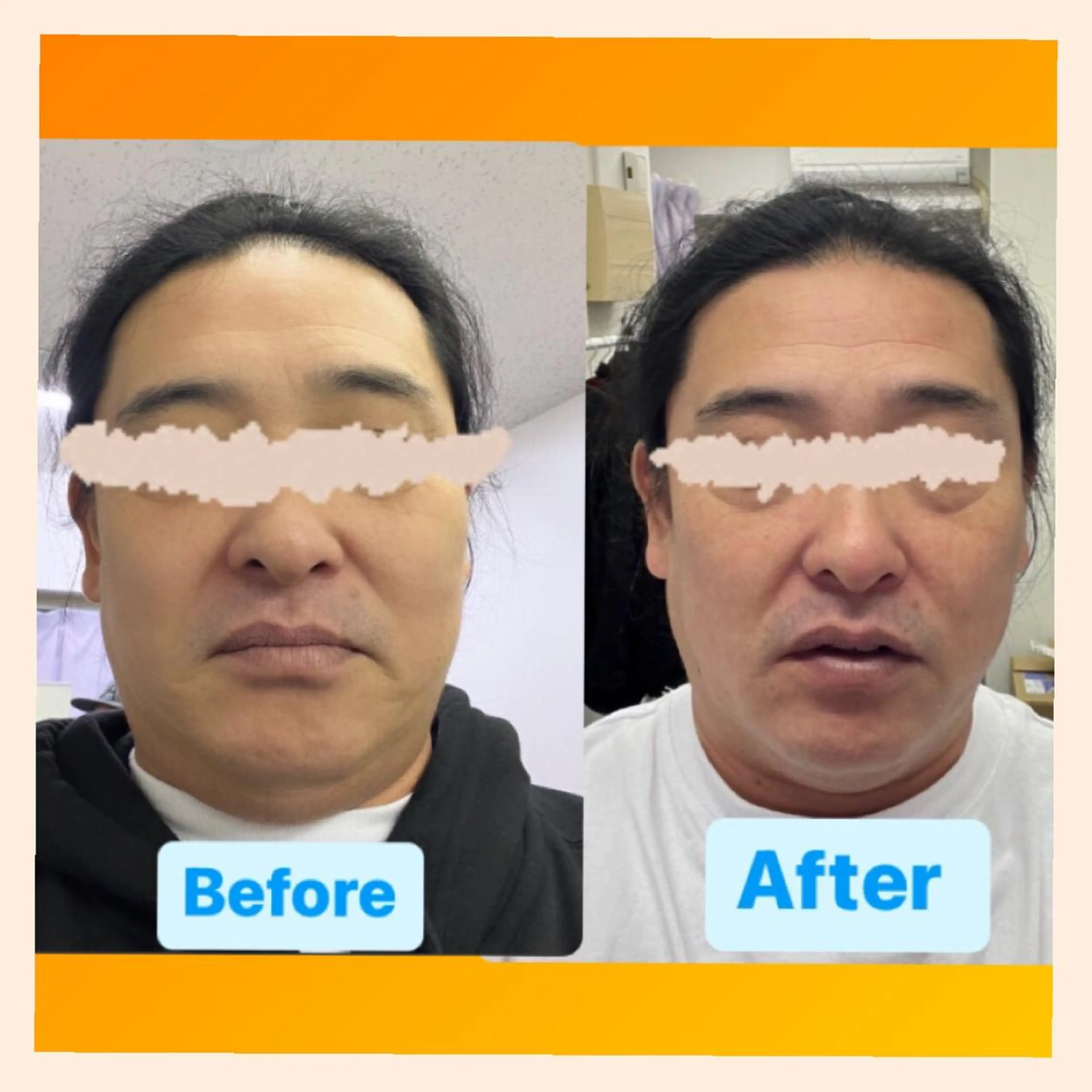 メンズ セルフエステ ALL in ONE所属・1組貸切 セルフエステのエステ・リラクイメージ