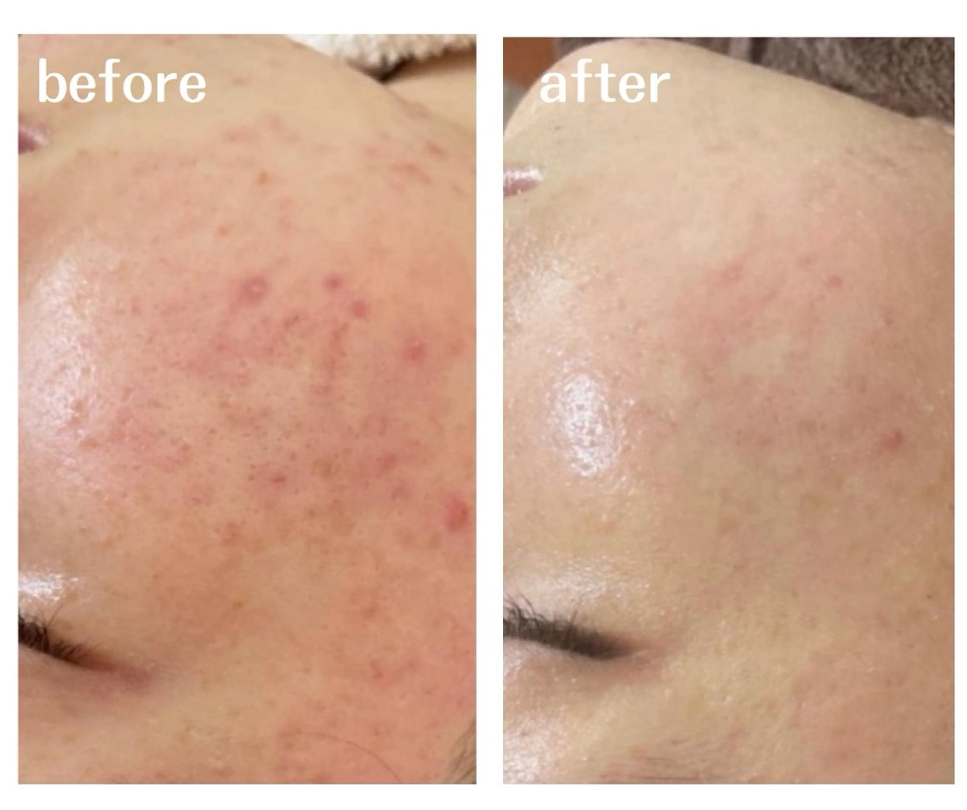 aimee　肌質改善サロン【アイミー】所属・肌質改善サロン aimee｜アイミーのエステ・リラクイメージ