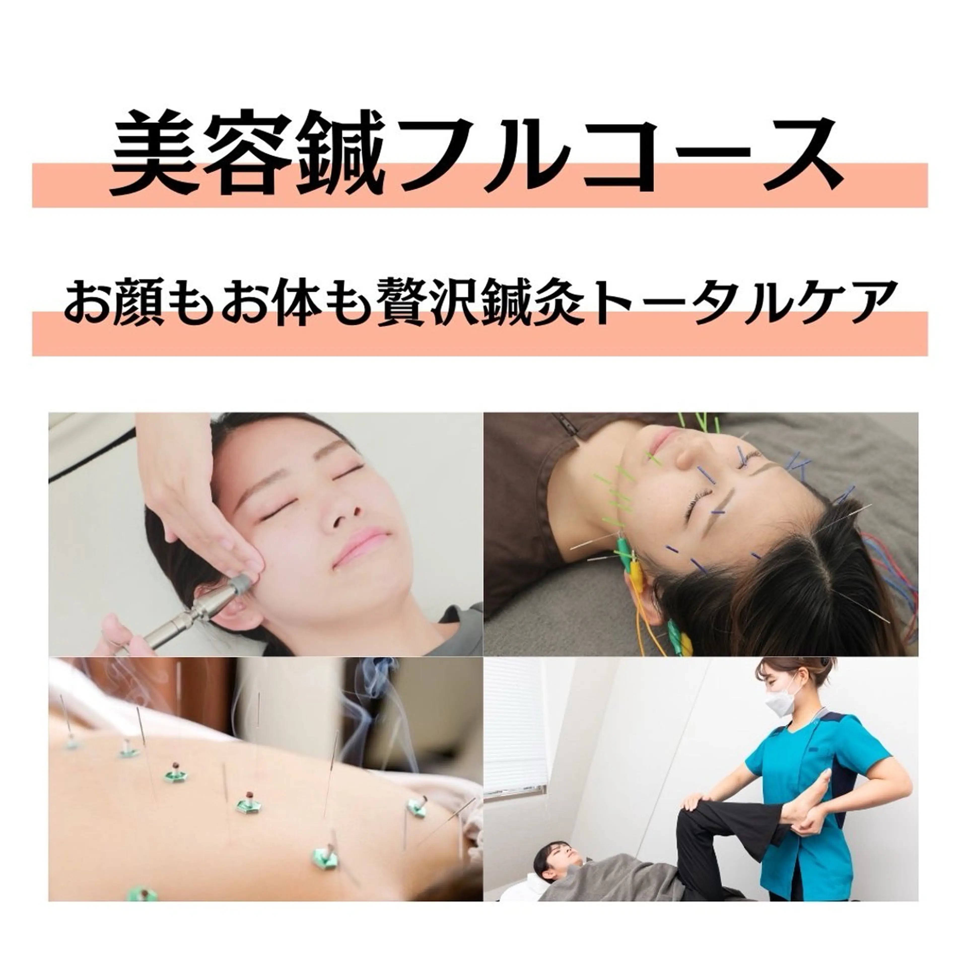 《🪡初回限定💆》贅沢トータルケア❣️美容鍼＋小顔矯正＋全身鍼＋美骨整体（120分）の写真