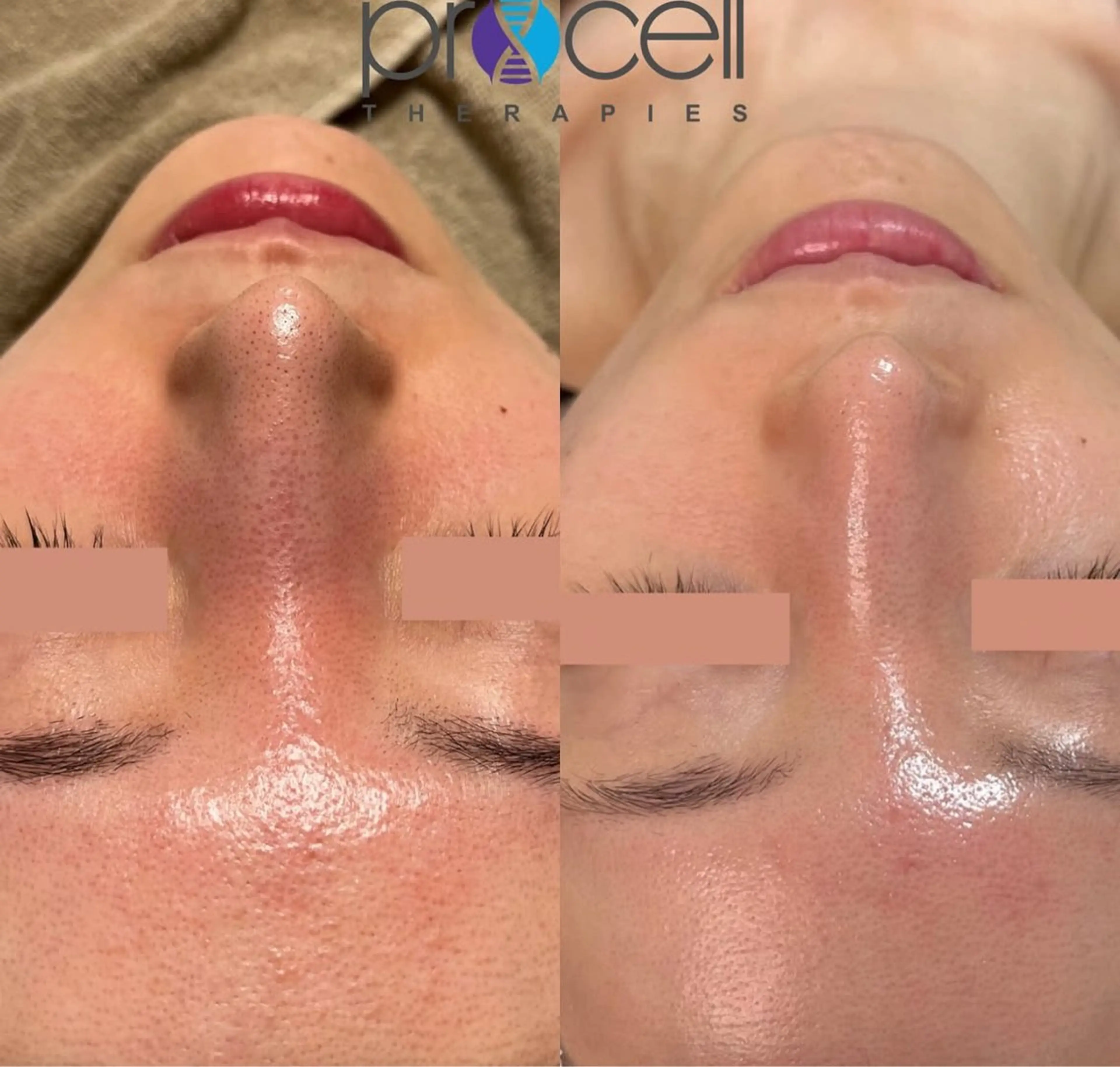 LOUISE. ／肌質・頭皮のエステ・リラクイメージ